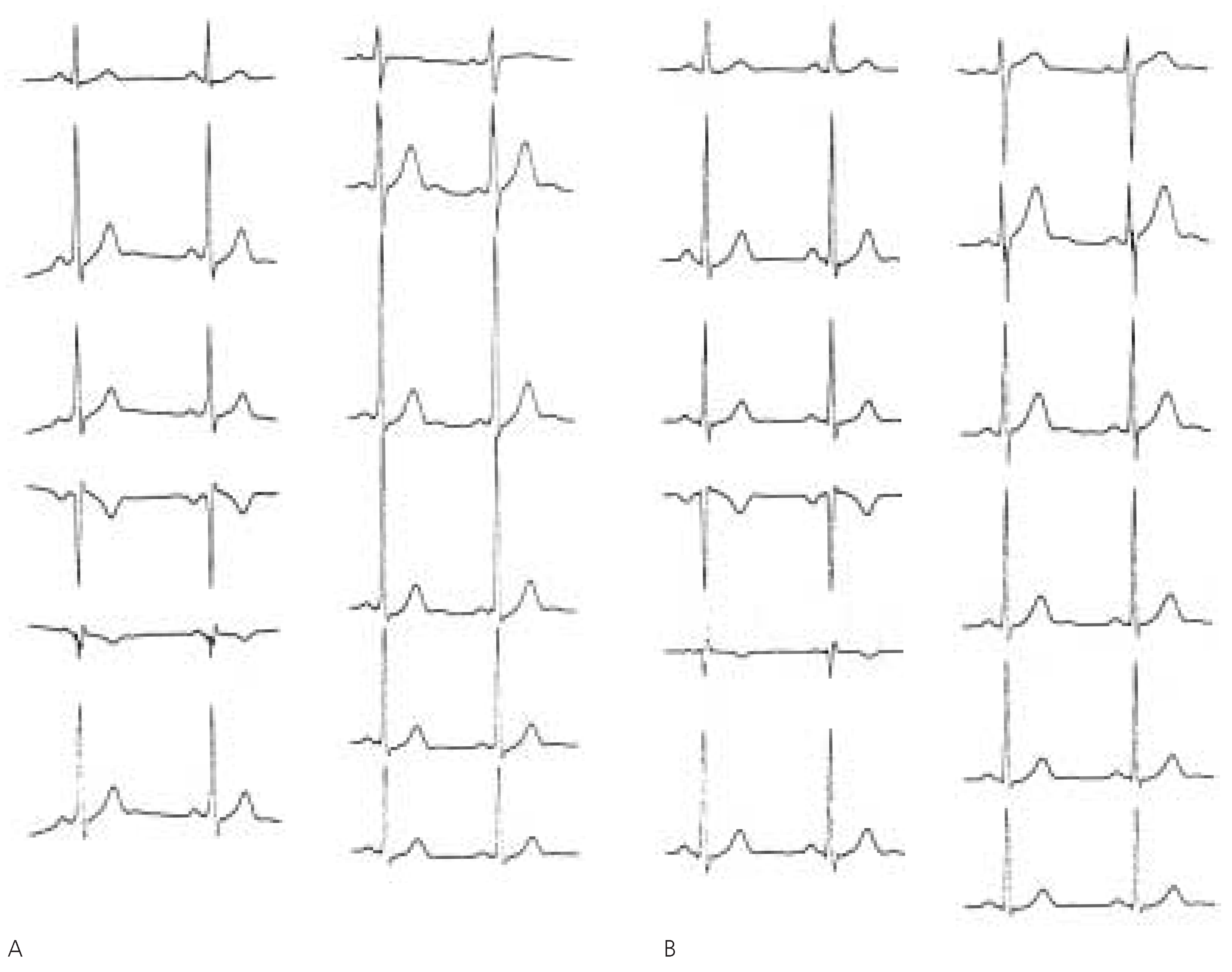 Cardiovascmed 08 00324 g001