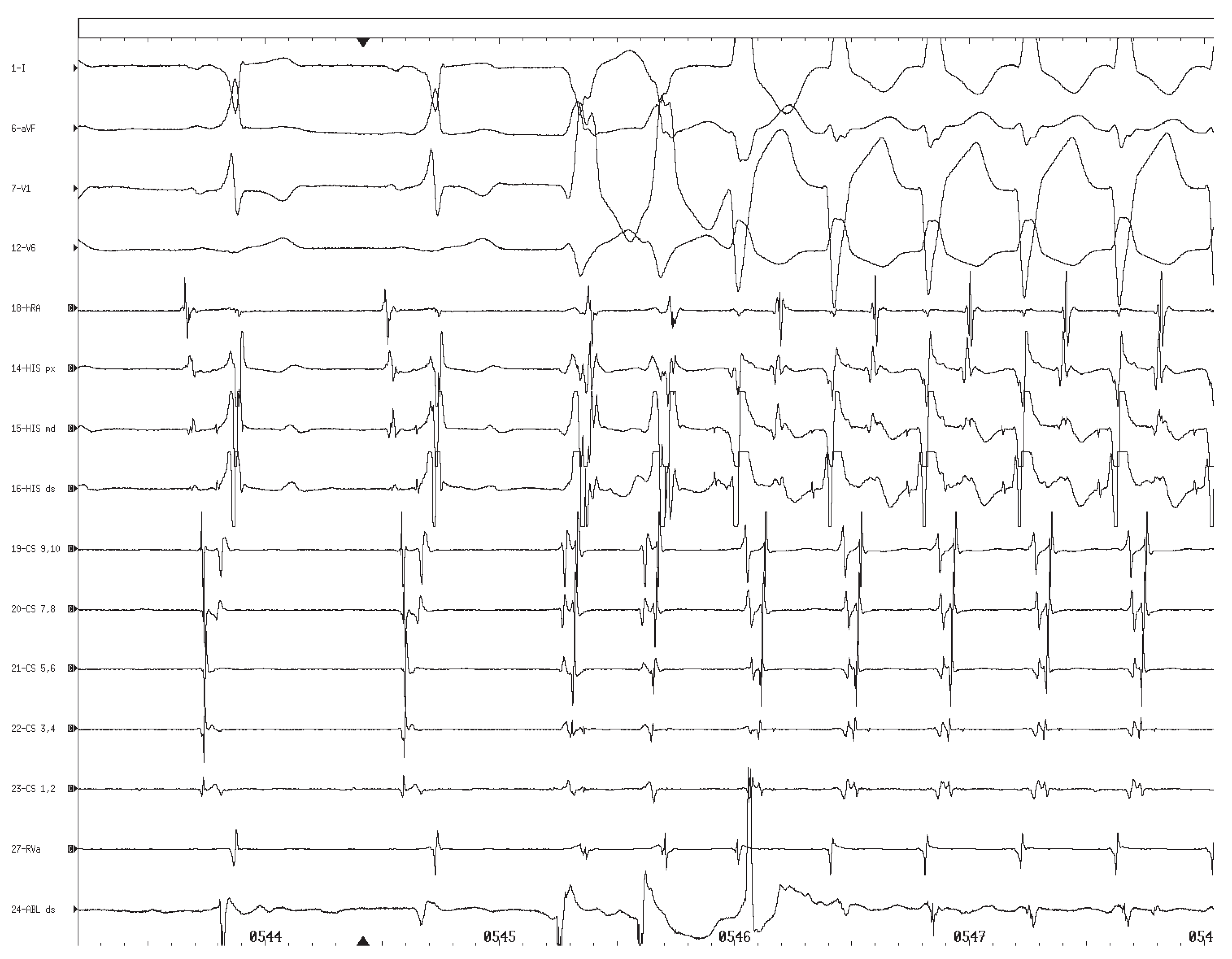 Cardiovascmed 08 00324 g002