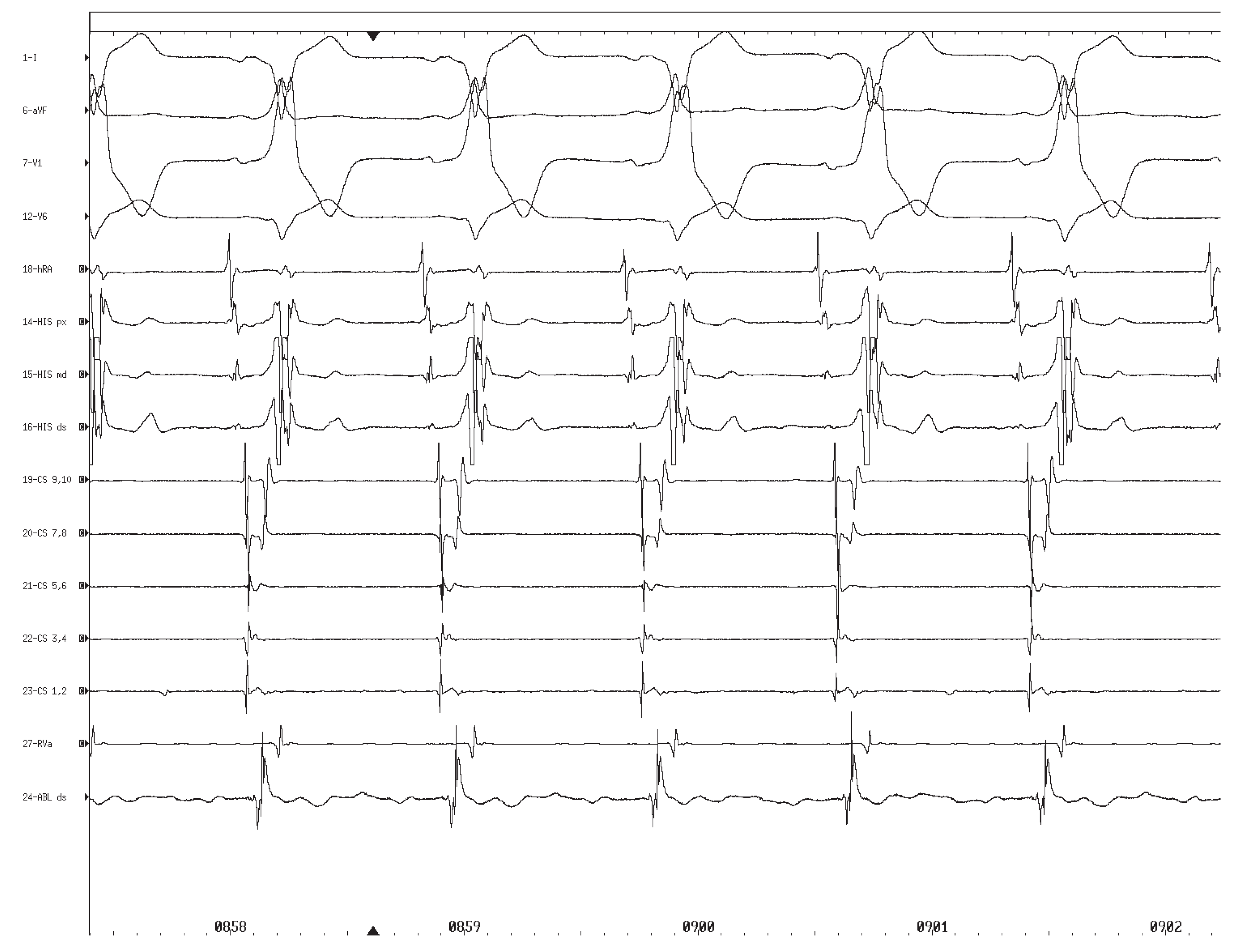 Cardiovascmed 08 00324 g003