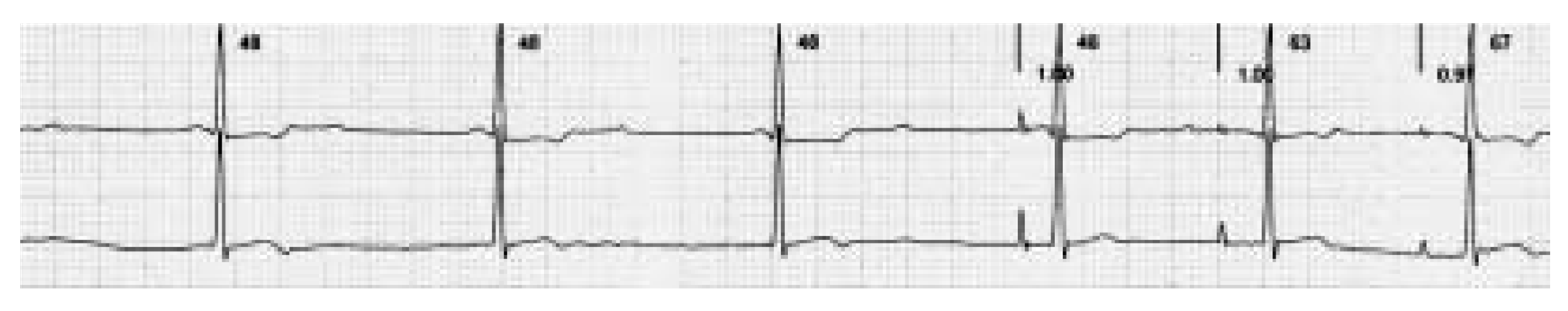 Cardiovascmed 08 00330 g001