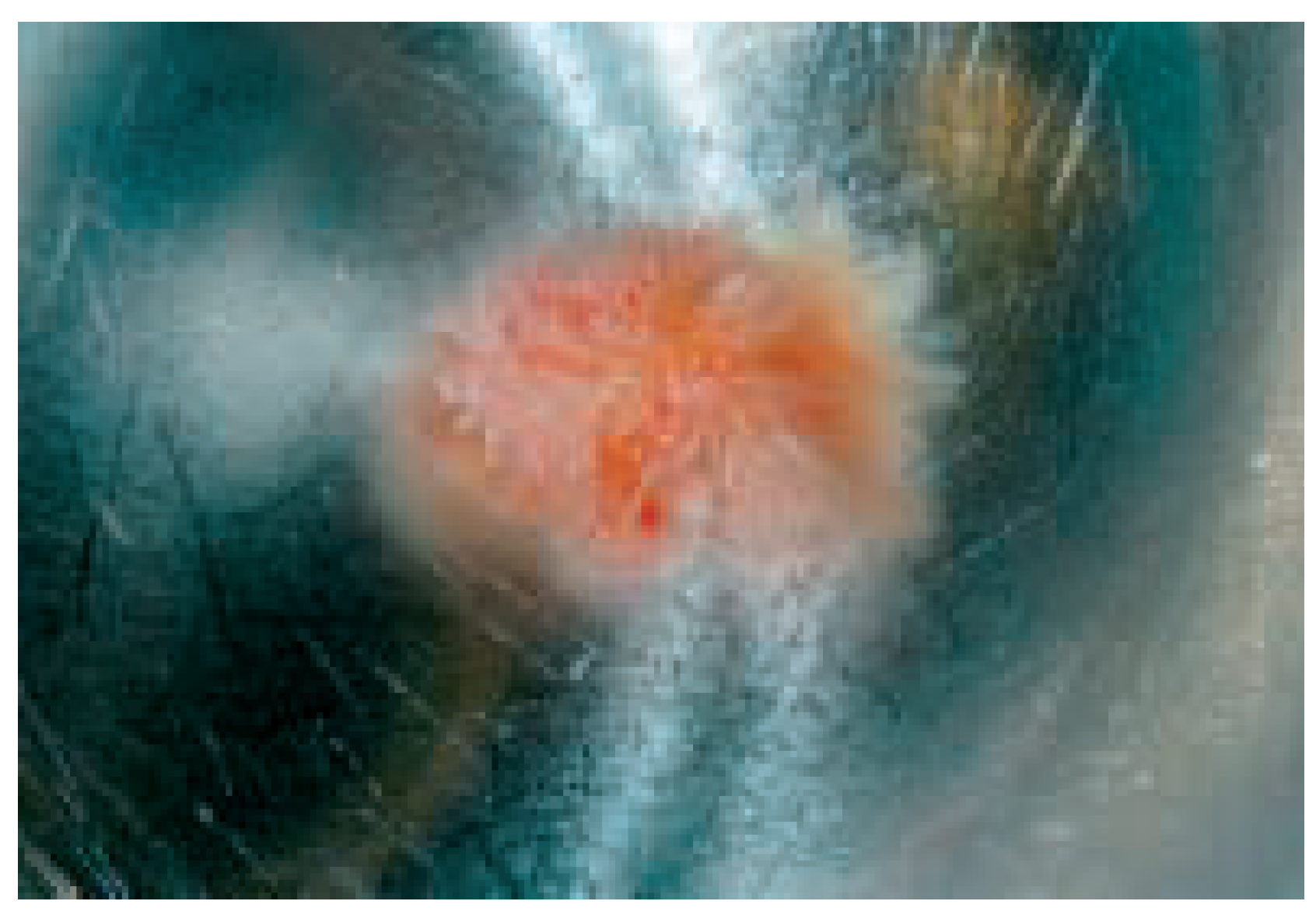 Cardiovascmed 08 00332 g002 Cardiovascmed 08 00332 g002