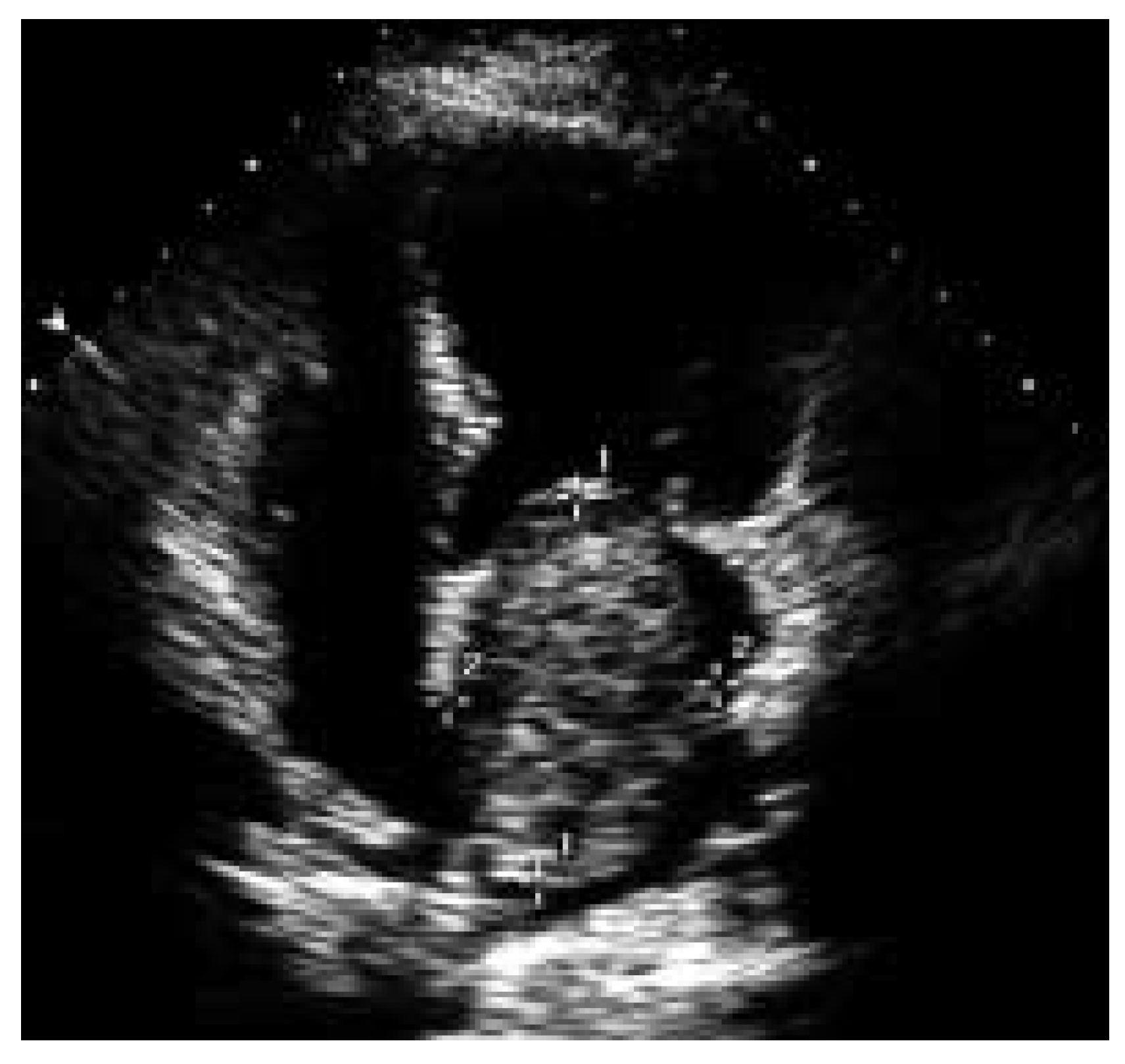 Cardiovascmed 08 00361 g003