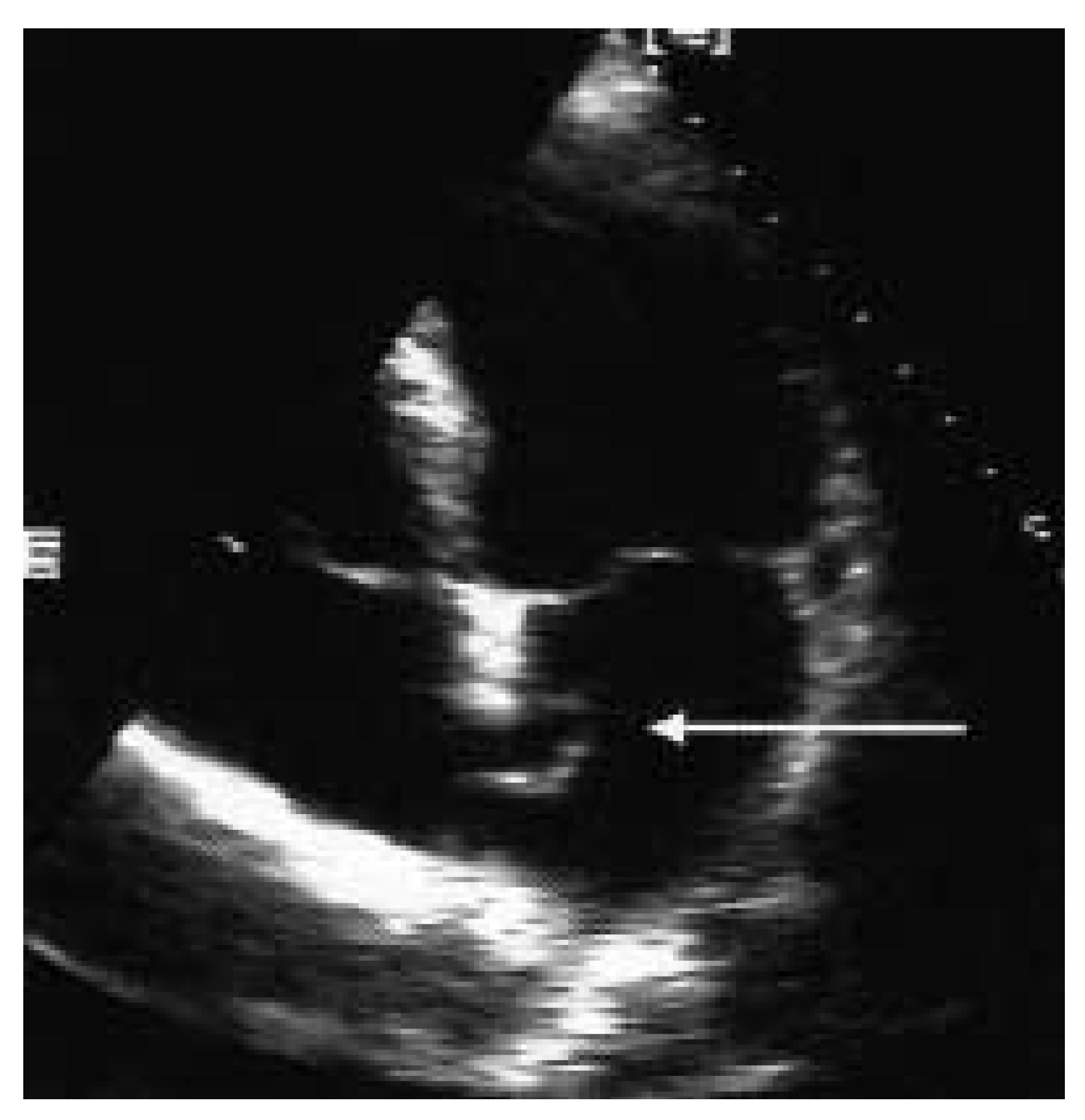 Cardiovascmed 08 00370 g001