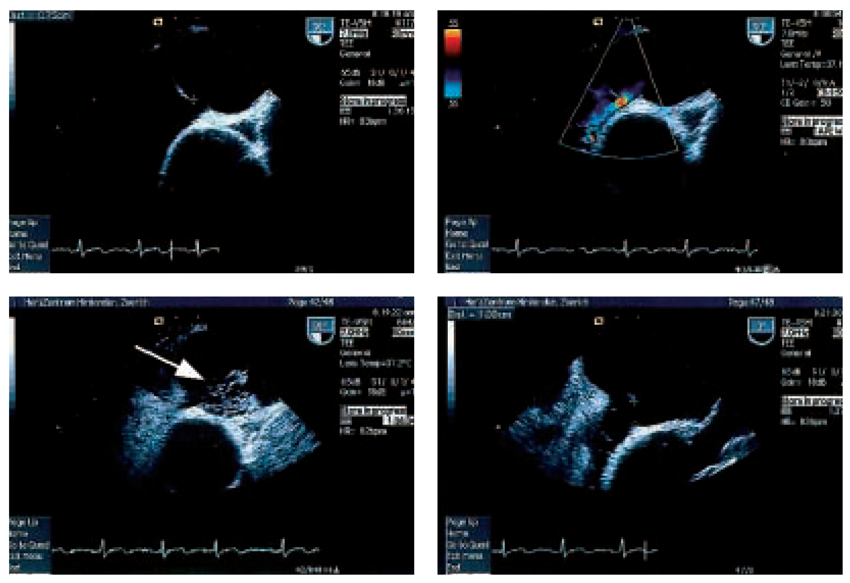 Cardiovascmed 08 00370 g002