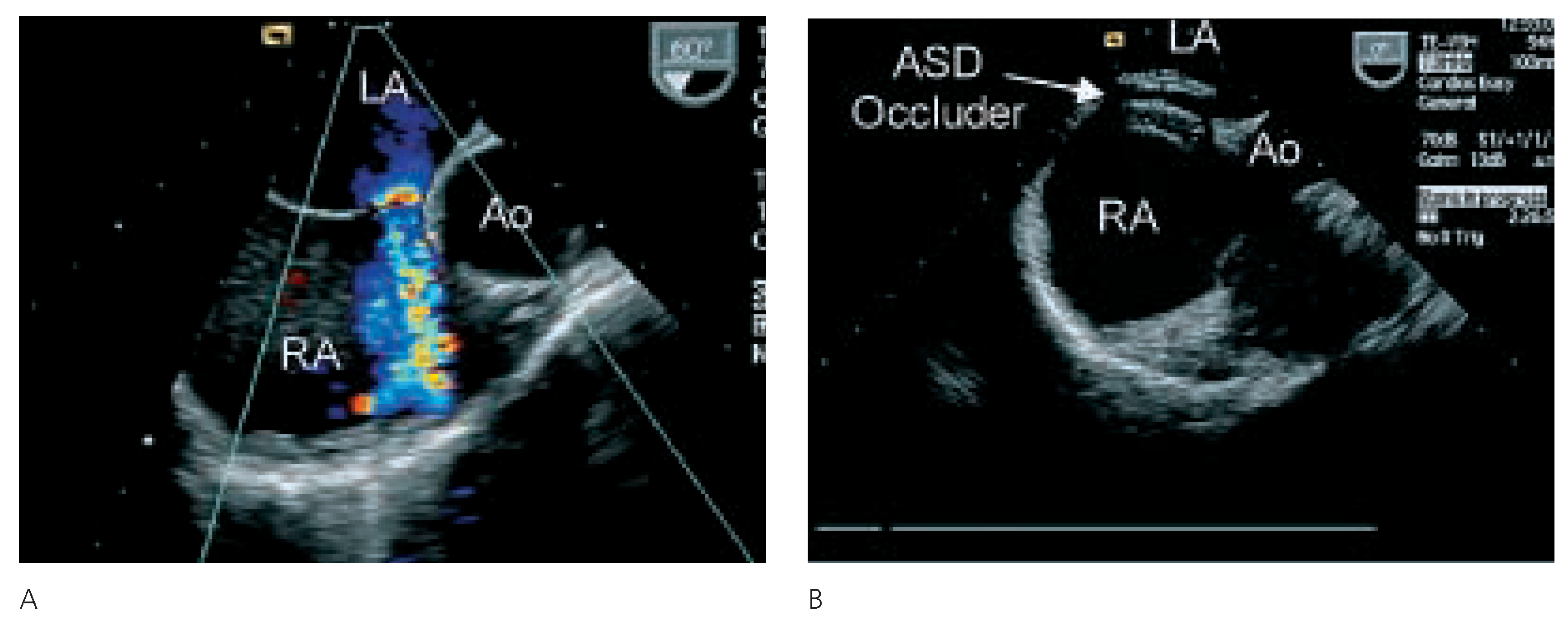 Cardiovascmed 08 00370 g003
