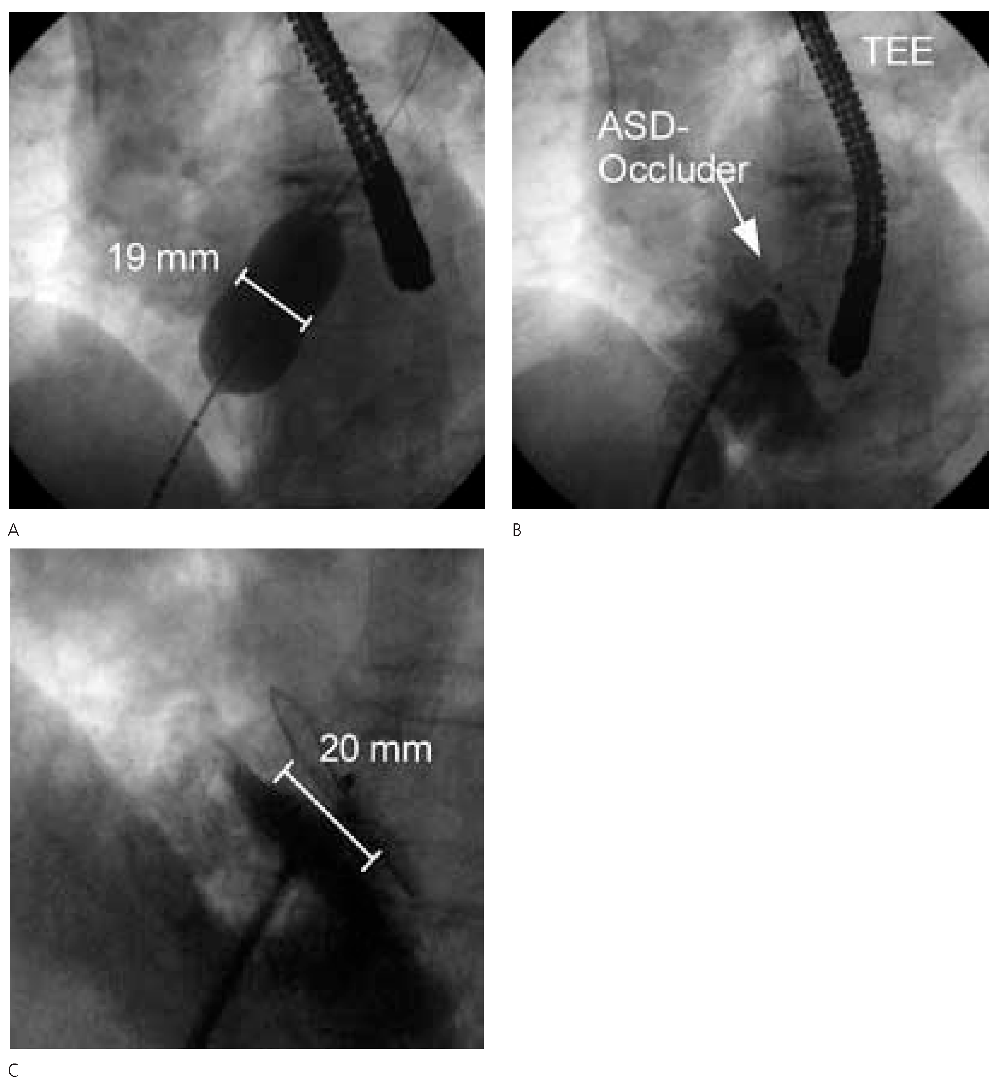 Cardiovascmed 08 00370 g004