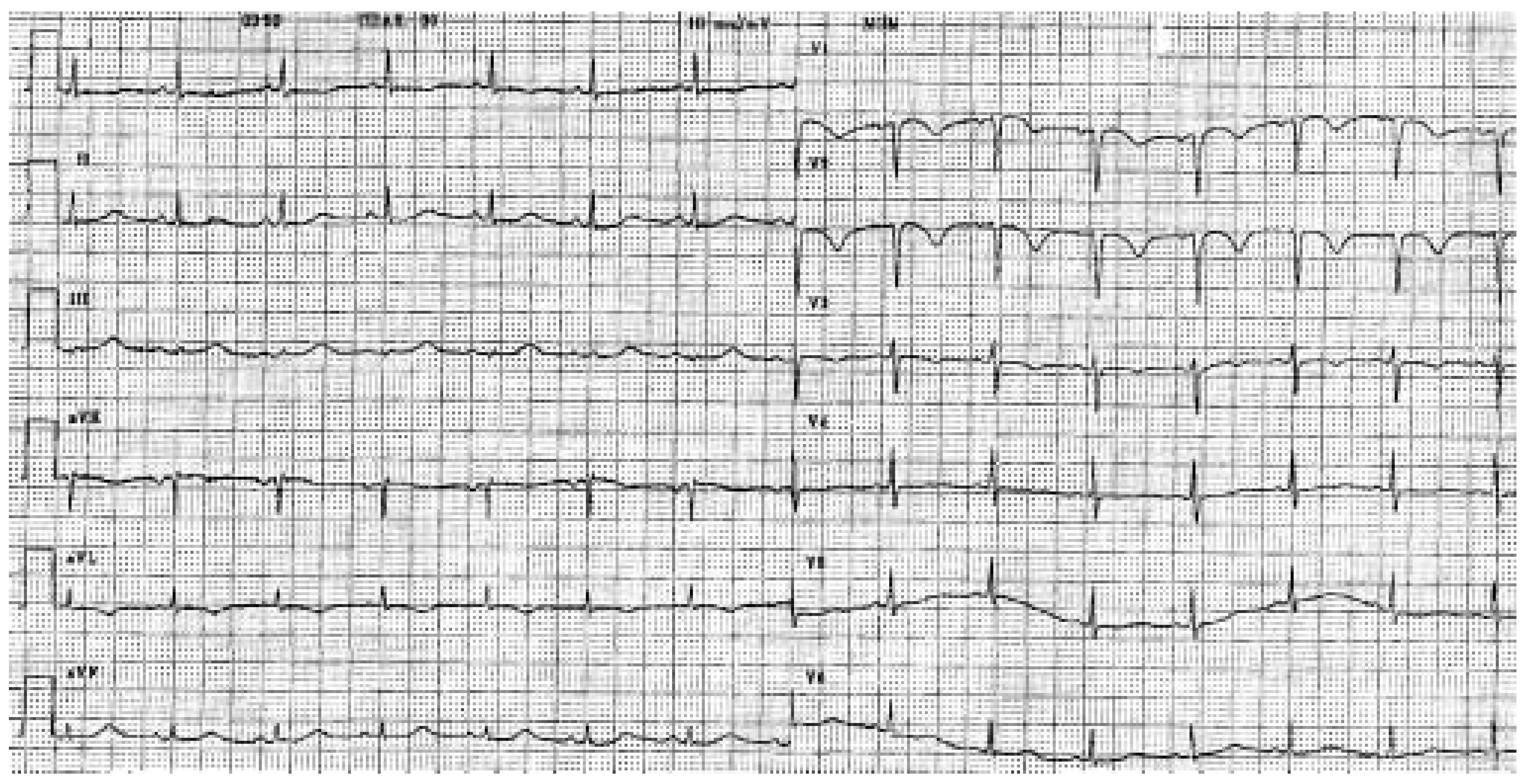 Cardiovascmed 08 00376 g002 Cardiovascmed 08 00376 g002