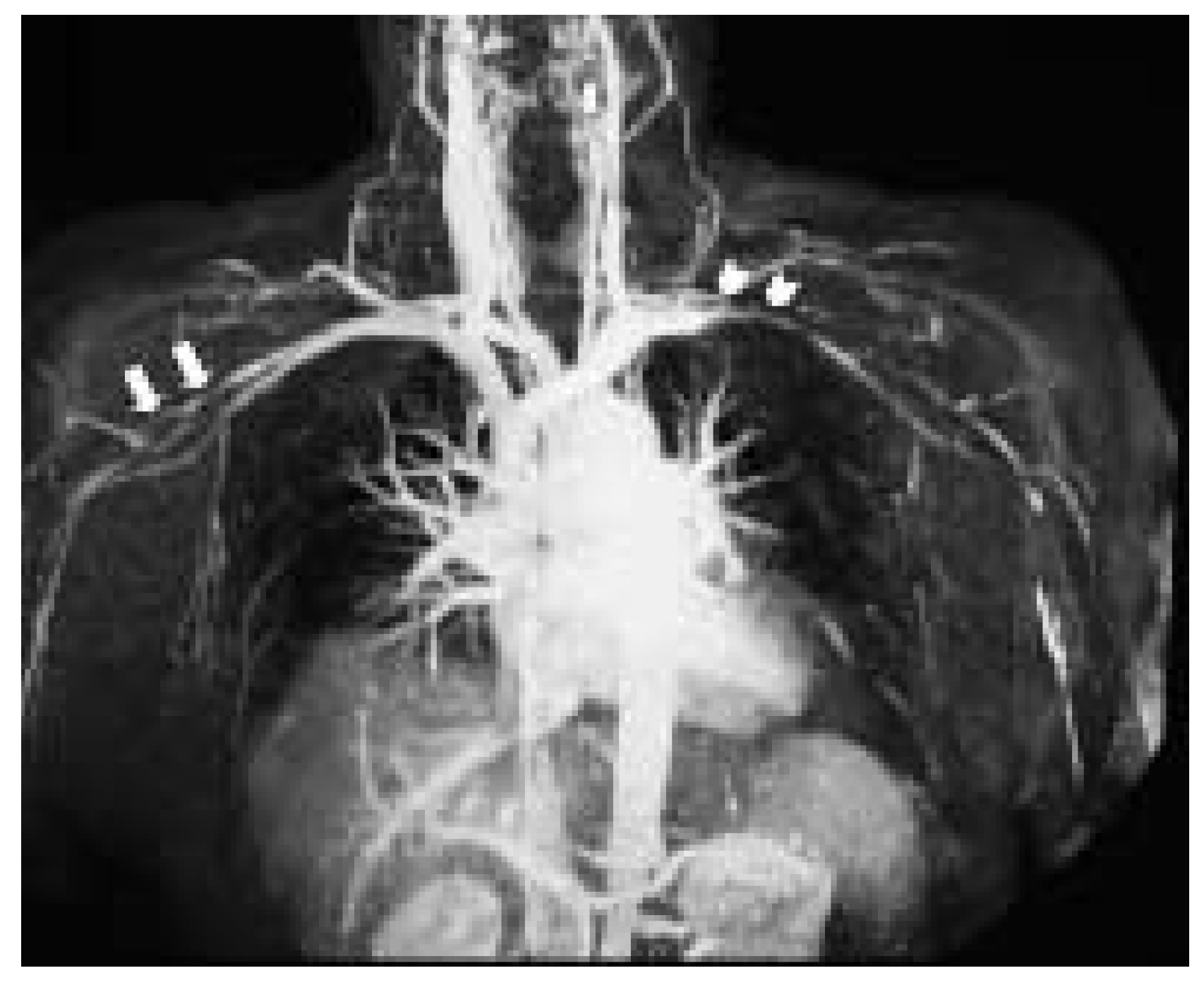 Cardiovascmed 08 00378 g001 Cardiovascmed 08 00378 g001