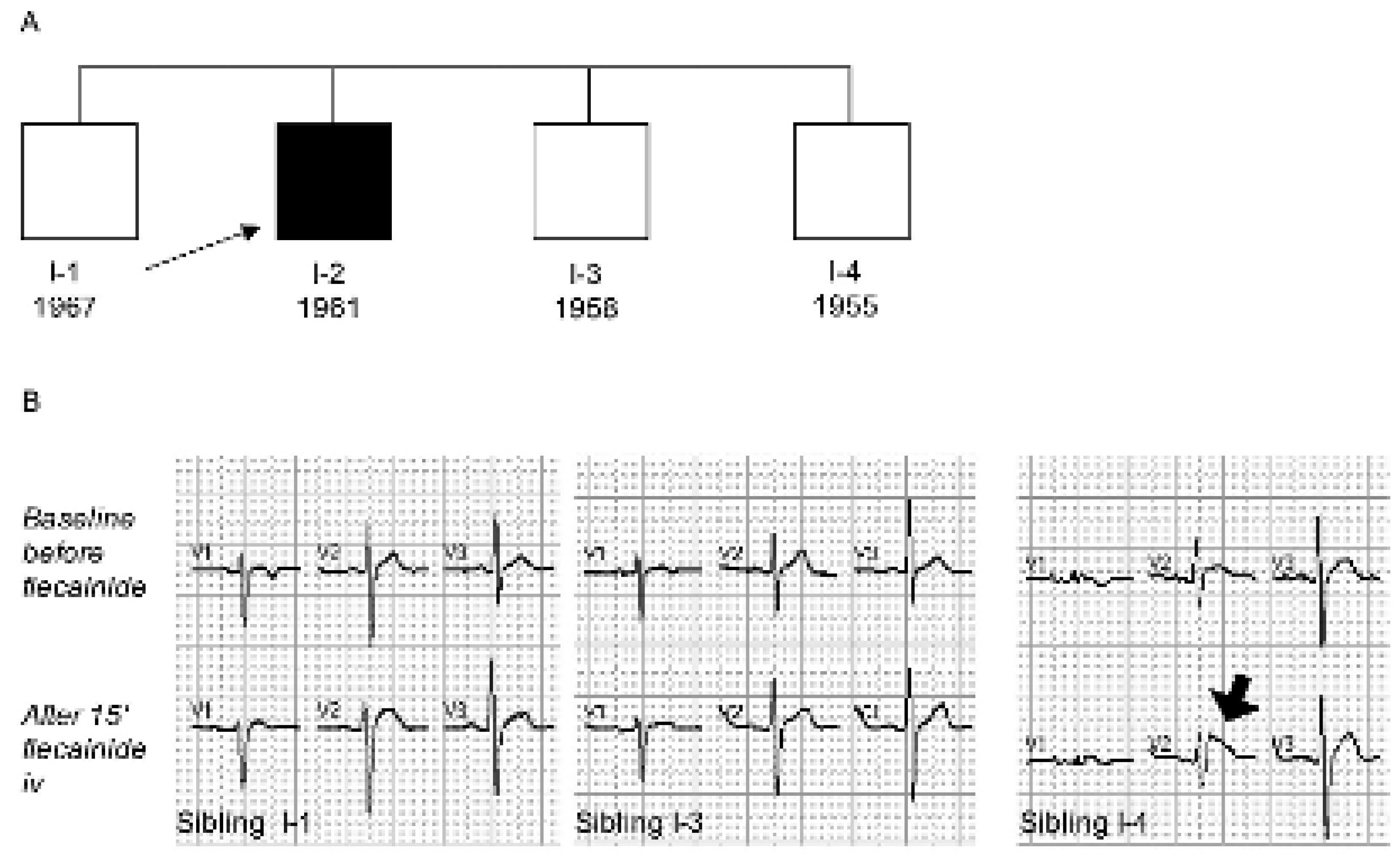 Cardiovascmed 08 00410 g002 Cardiovascmed 08 00410 g002