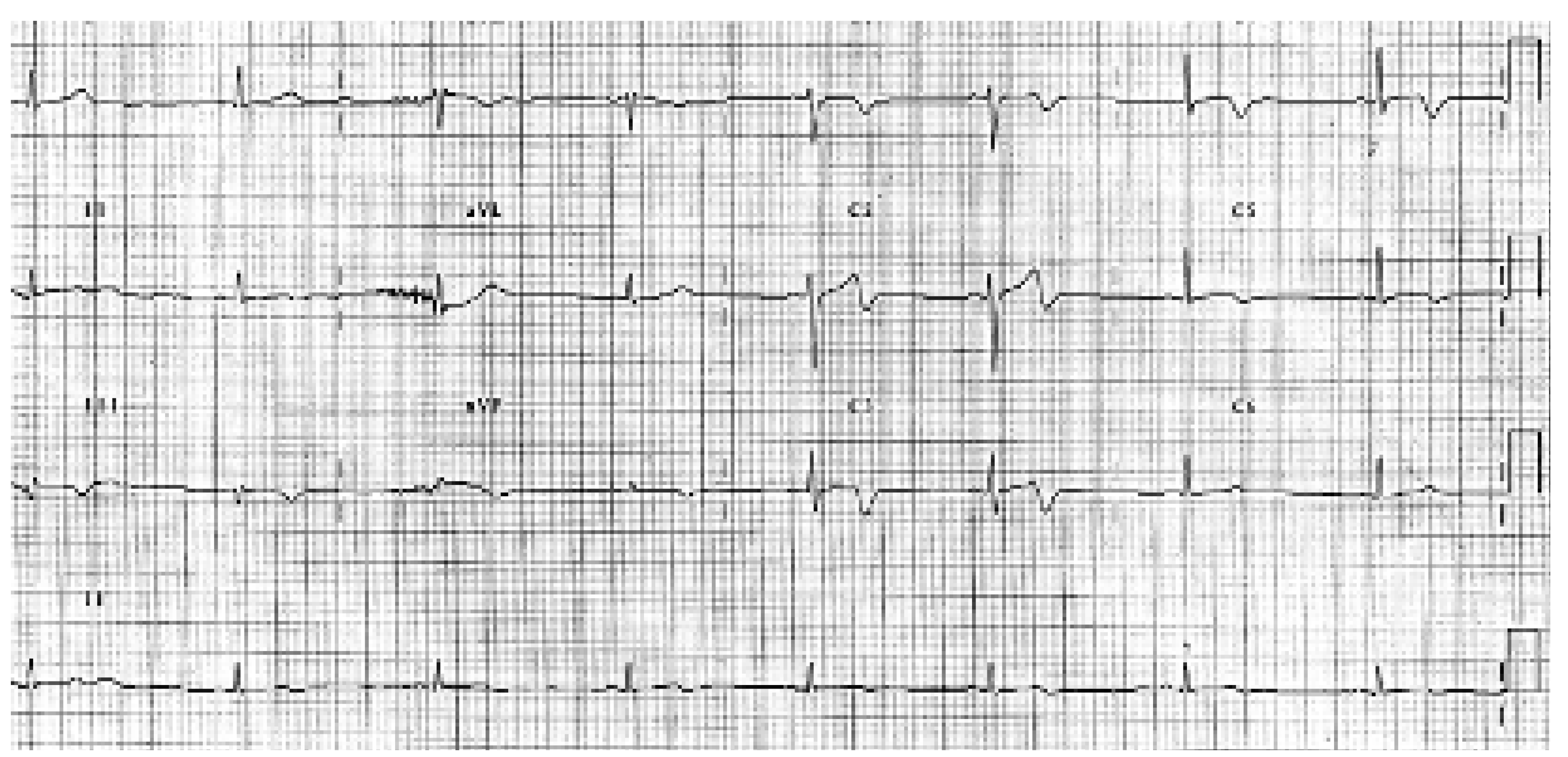 Cardiovascmed 08 00412 g001