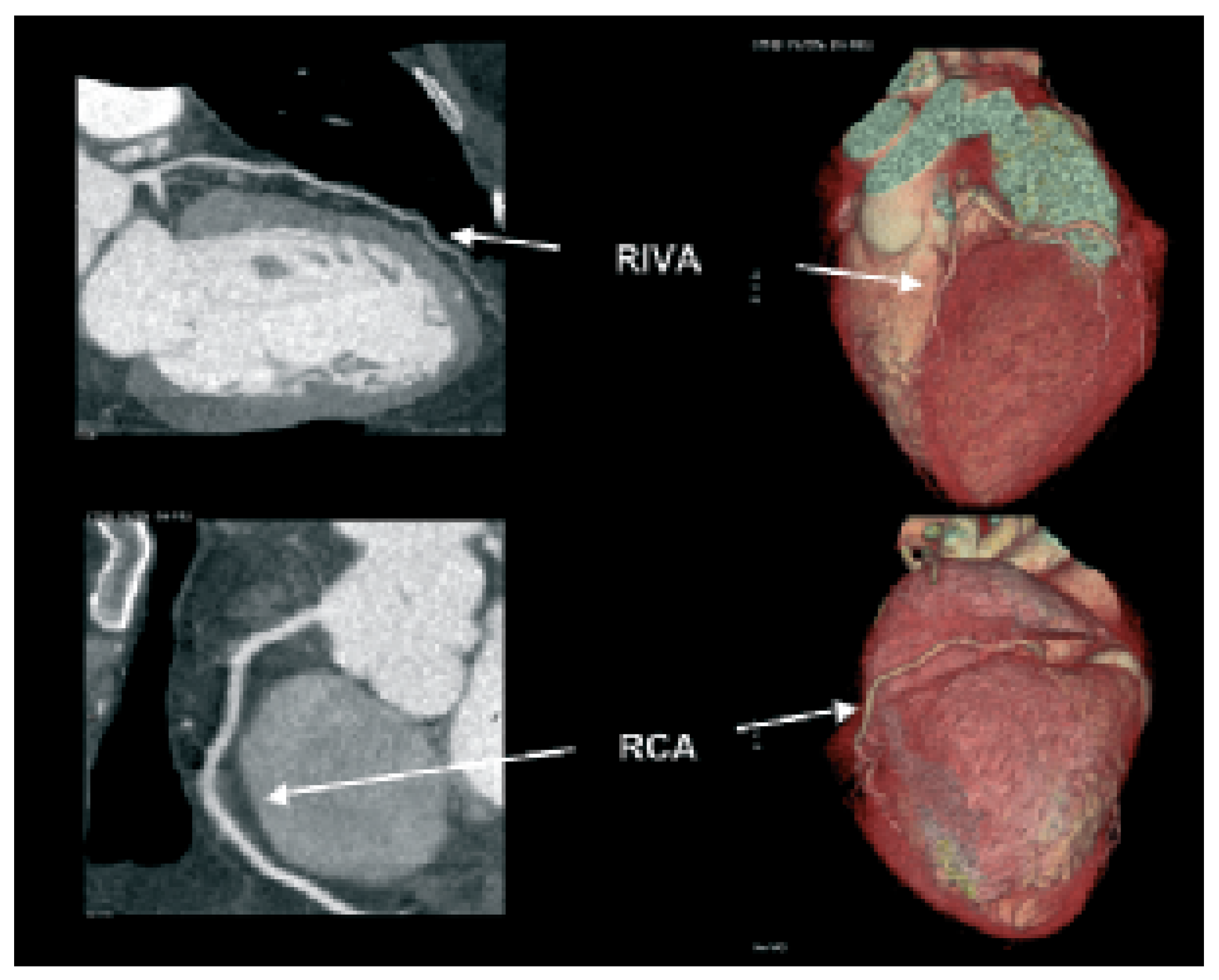 Cardiovascmed 08 00421 g001