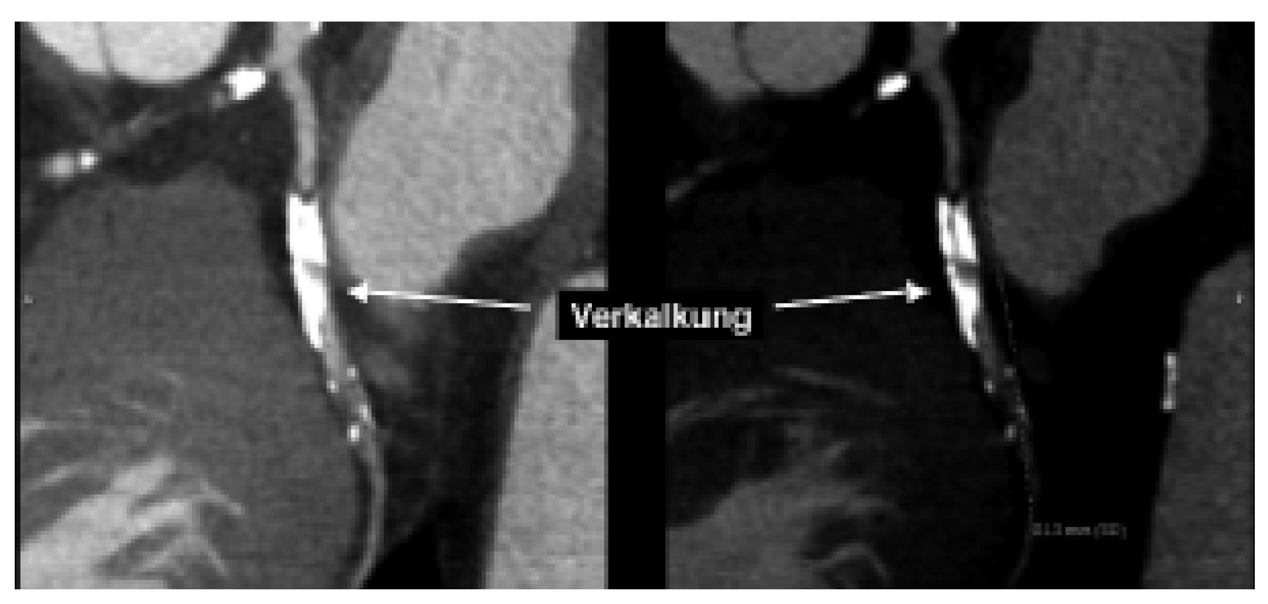 Cardiovascmed 08 00421 g002