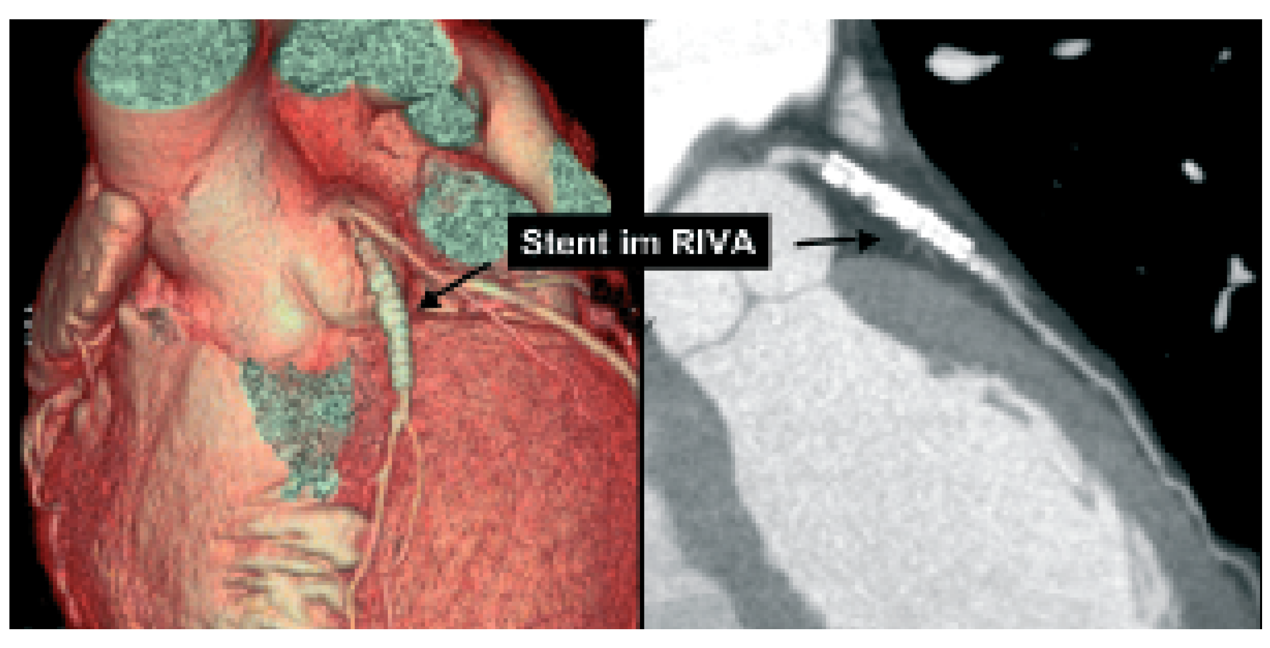 Cardiovascmed 08 00421 g003