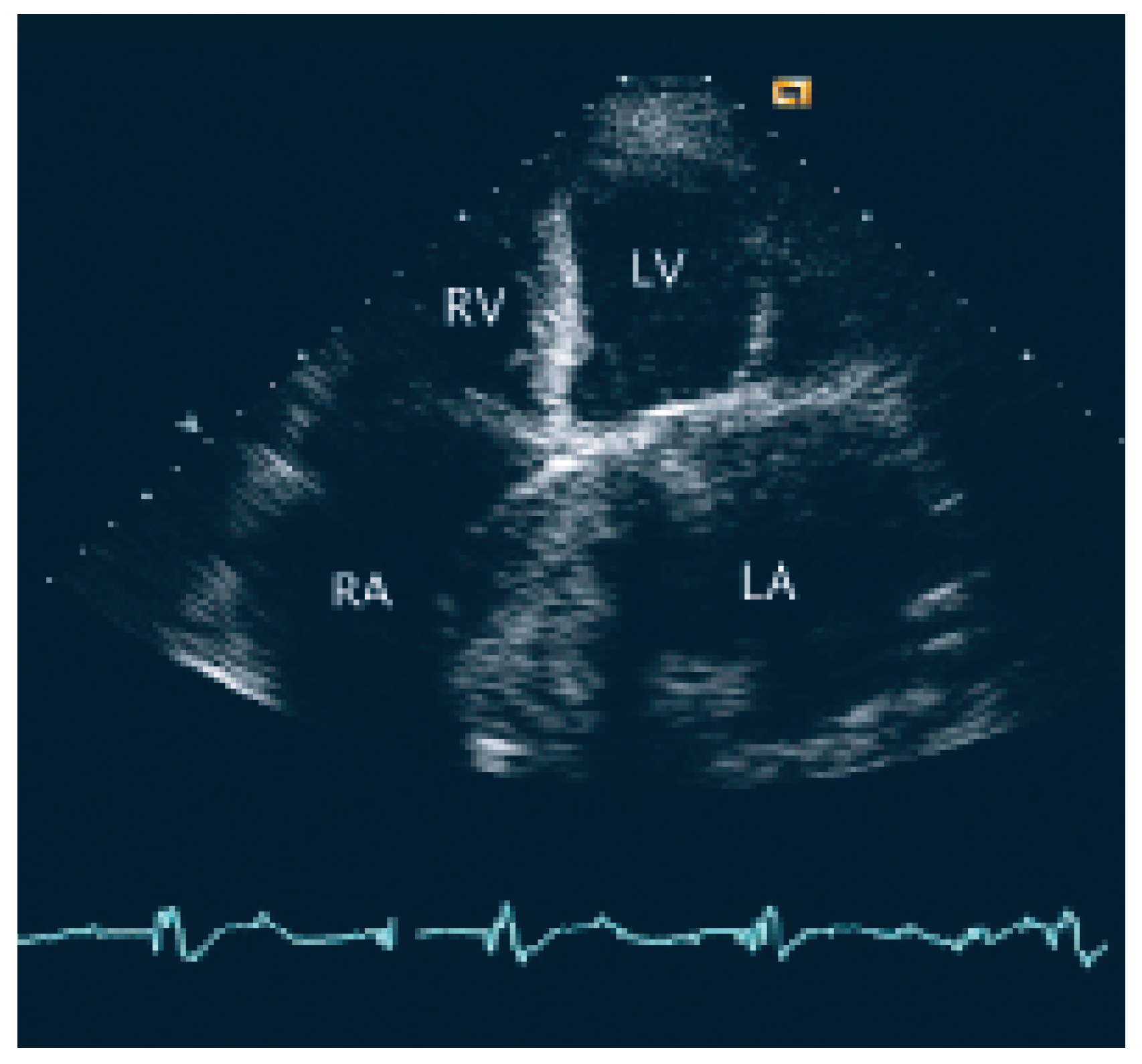 Cardiovascmed 09 00028 g001