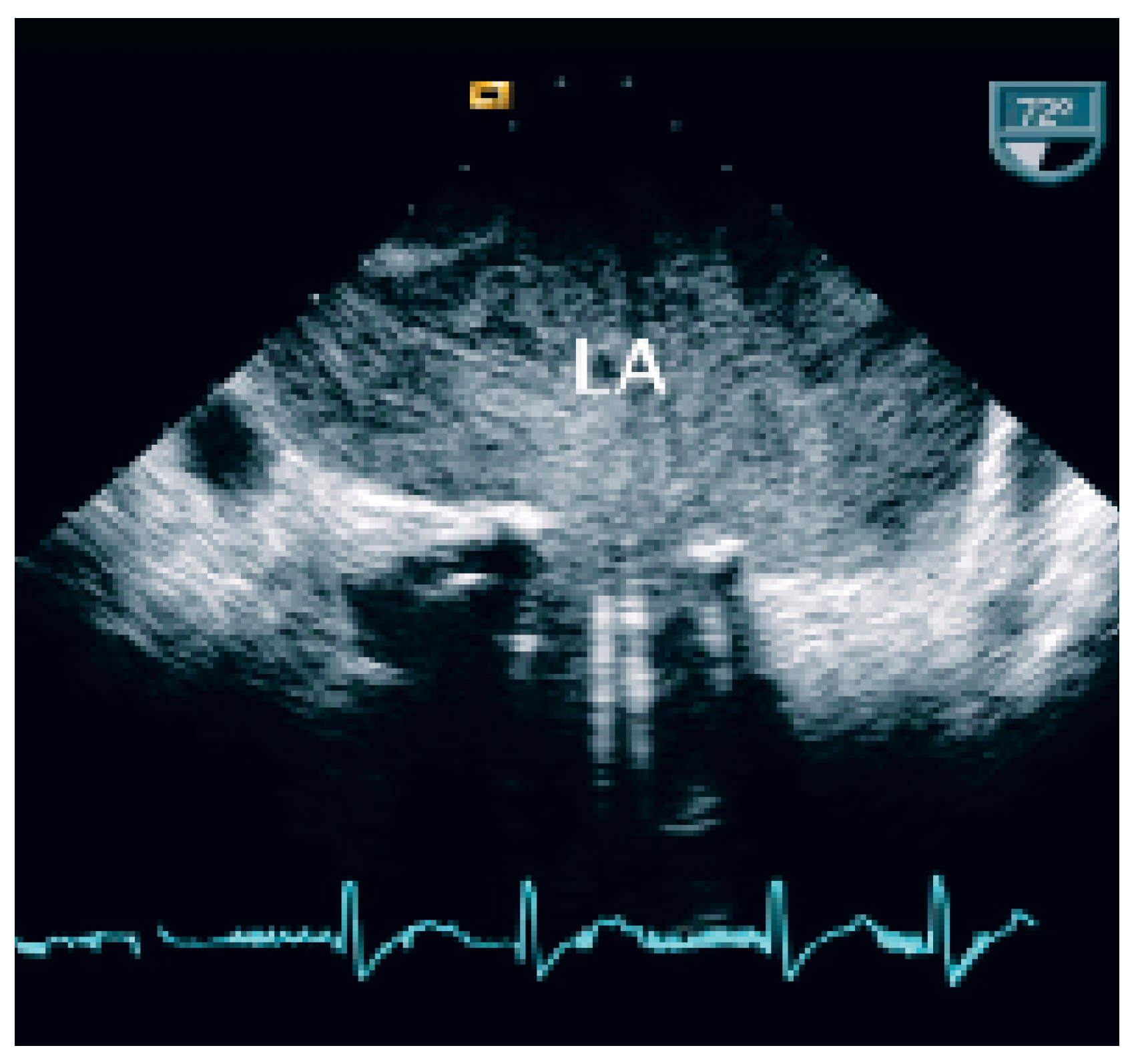 Cardiovascmed 09 00028 g002