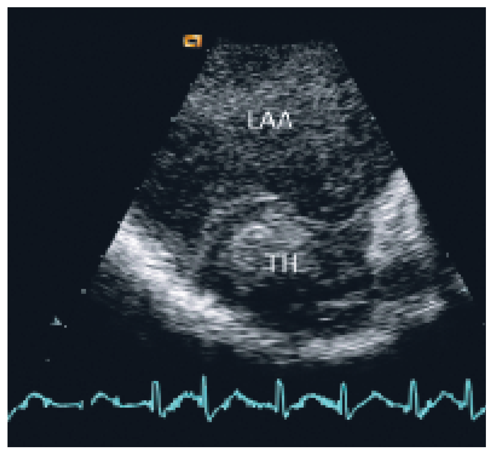 Cardiovascmed 09 00028 g003