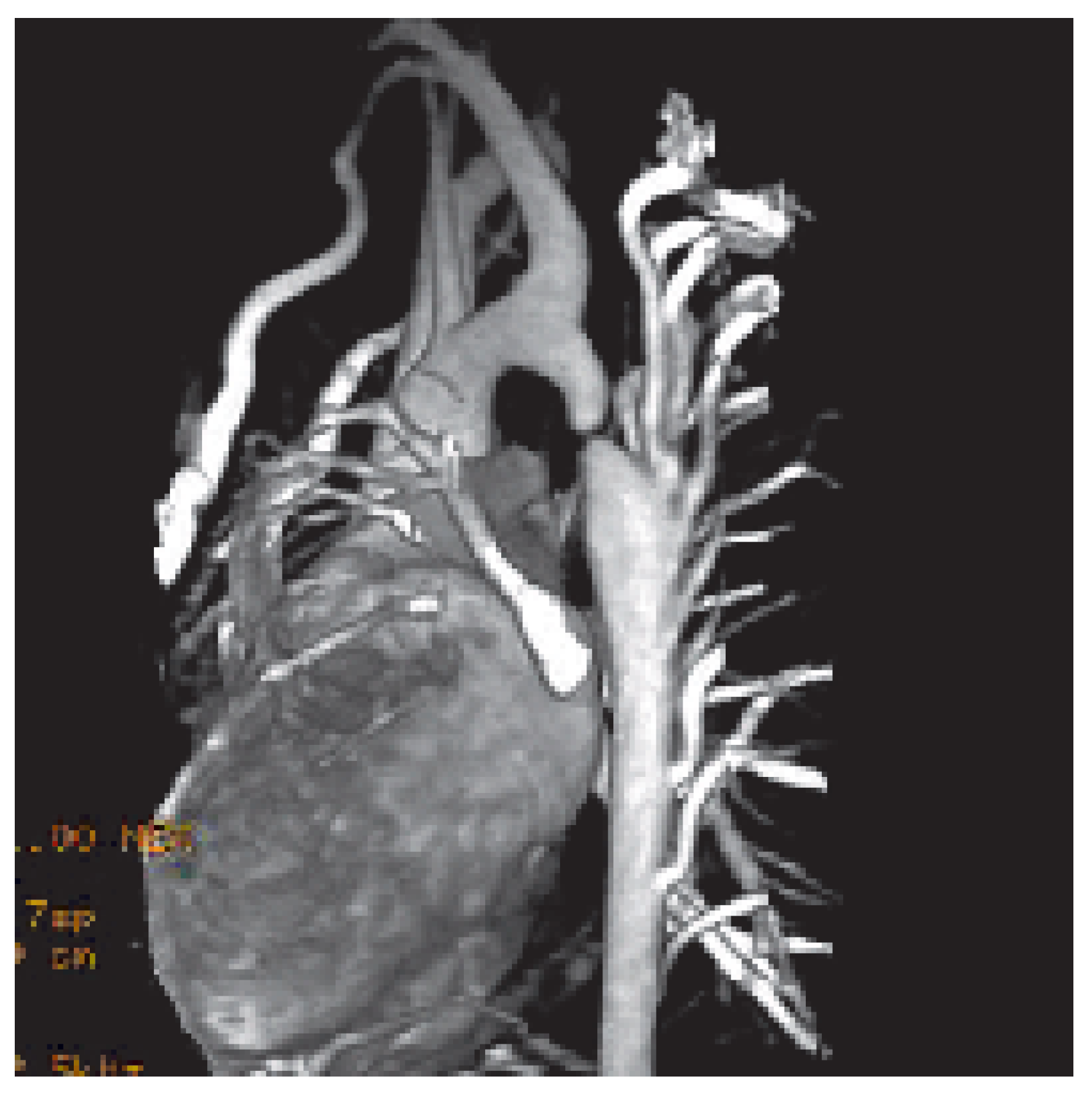 Cardiovascmed 09 00125 g002