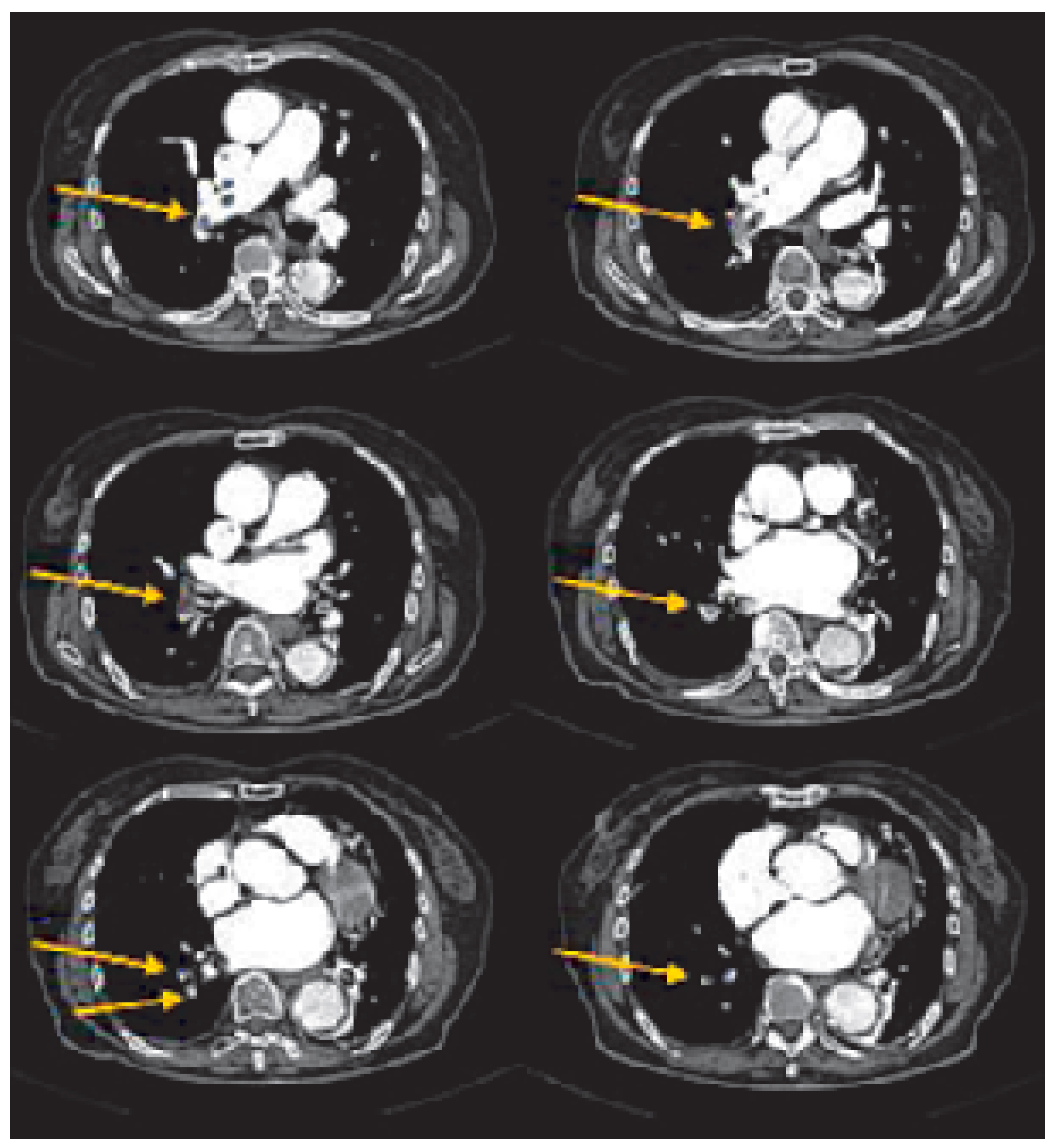 Cardiovascmed 09 00136 g003 Cardiovascmed 09 00136 g003