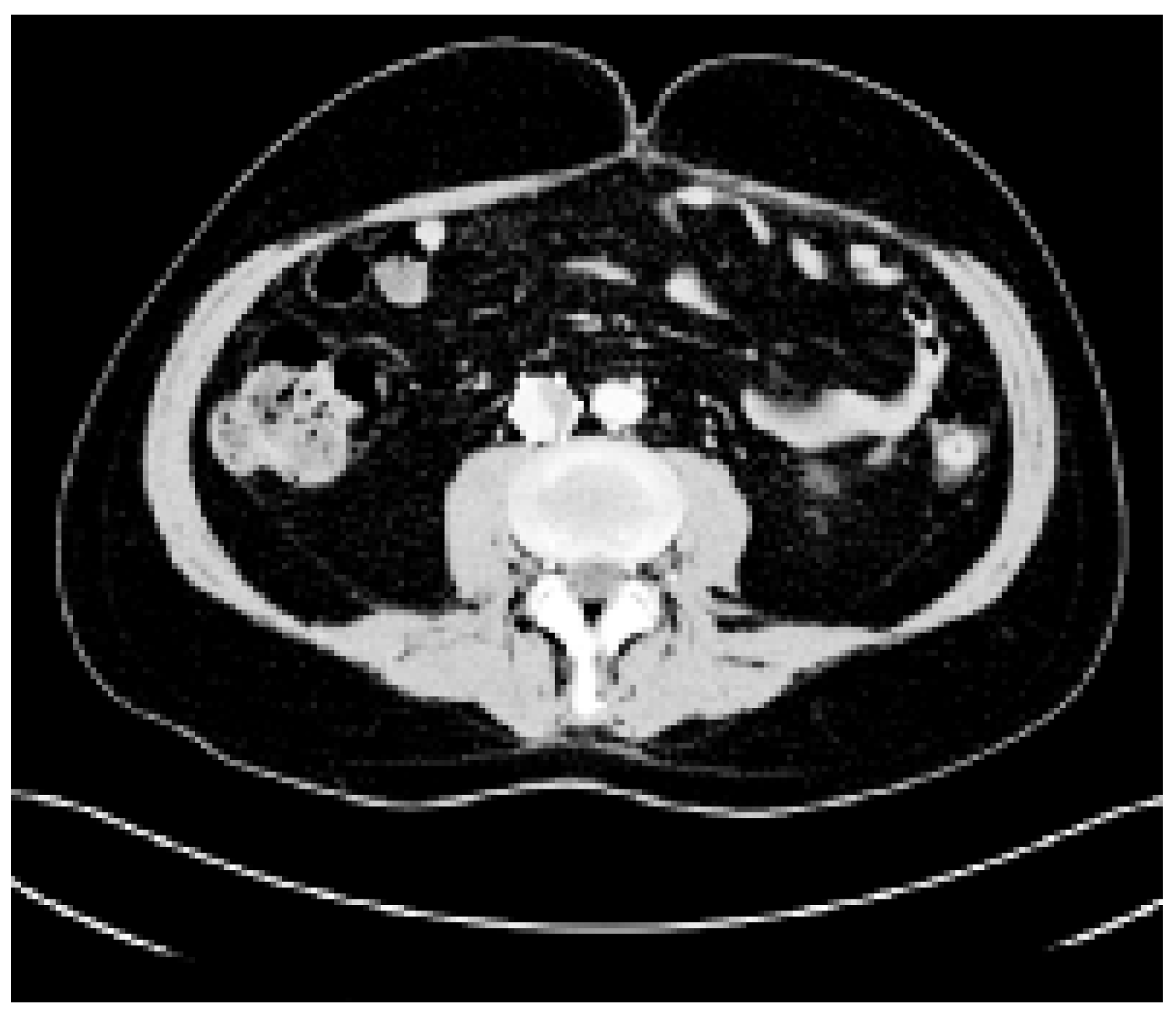 Cardiovascmed 09 00162 g001