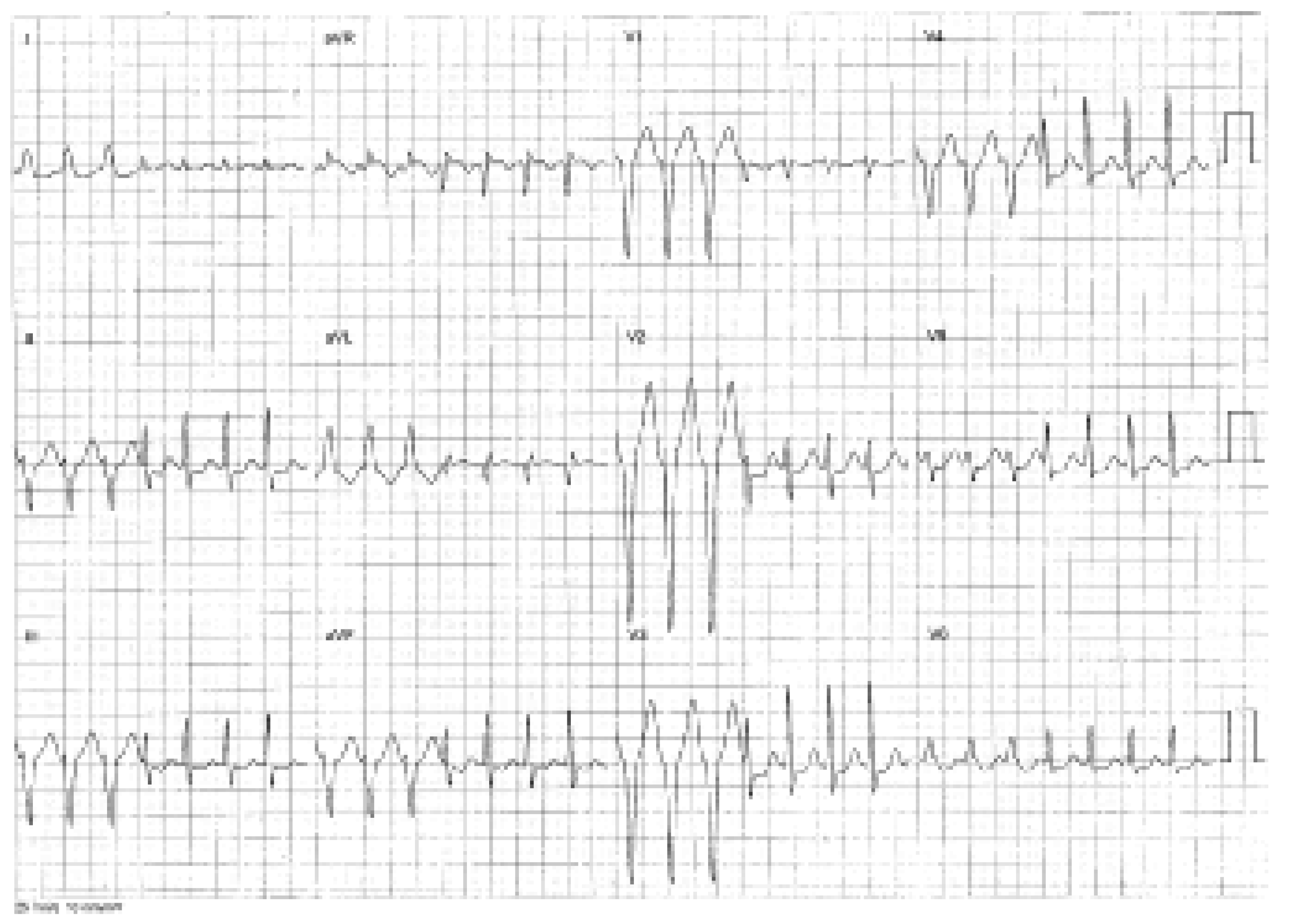 Cardiovascmed 09 00166 g001 Cardiovascmed 09 00166 g001