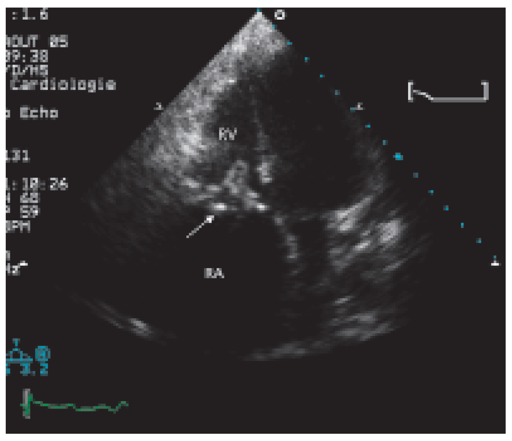 Cardiovascmed 09 00167 g001 Cardiovascmed 09 00167 g001
