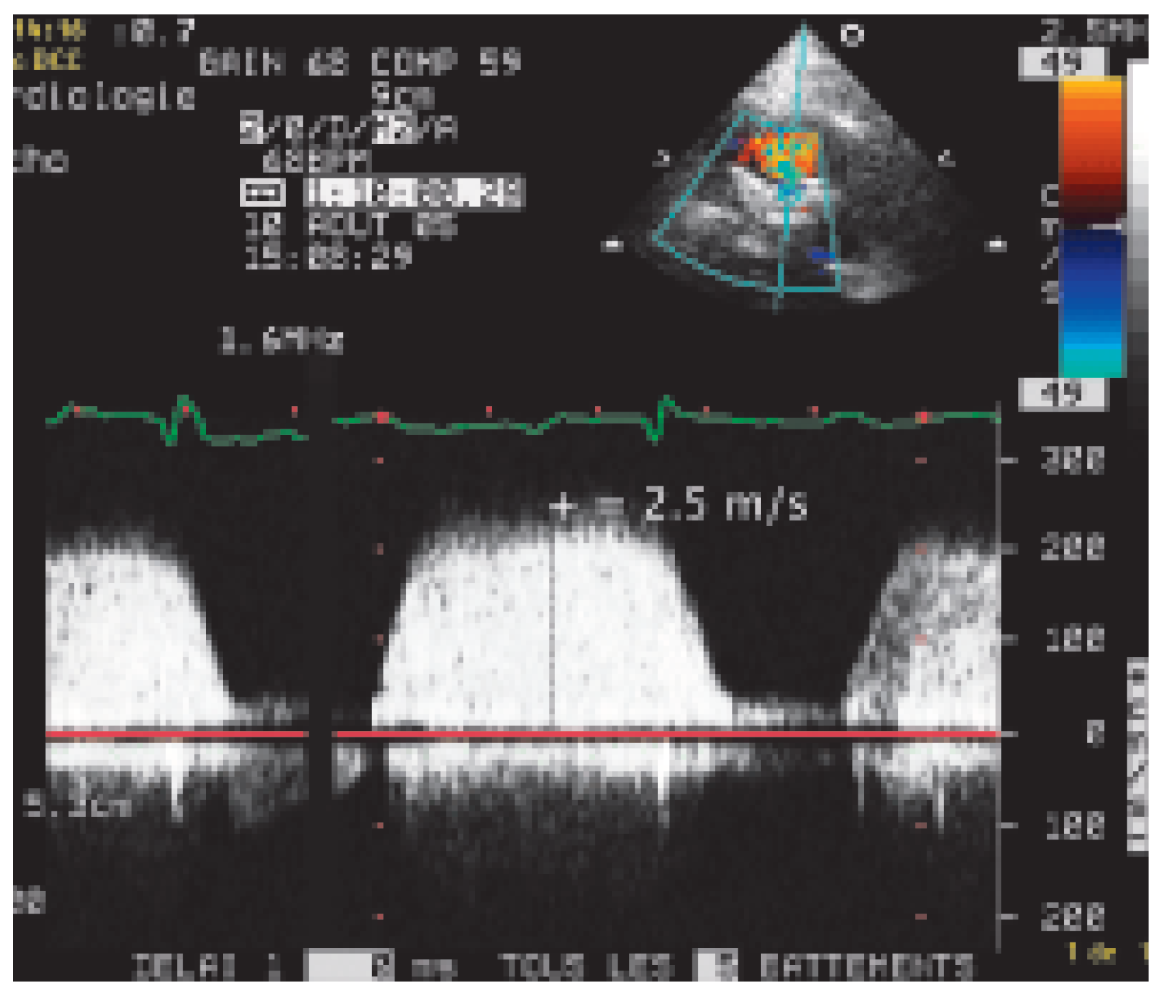 Cardiovascmed 09 00167 g002 Cardiovascmed 09 00167 g002