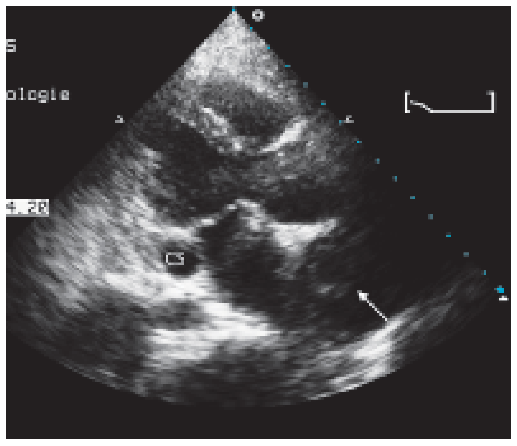 Cardiovascmed 09 00167 g003 Cardiovascmed 09 00167 g003