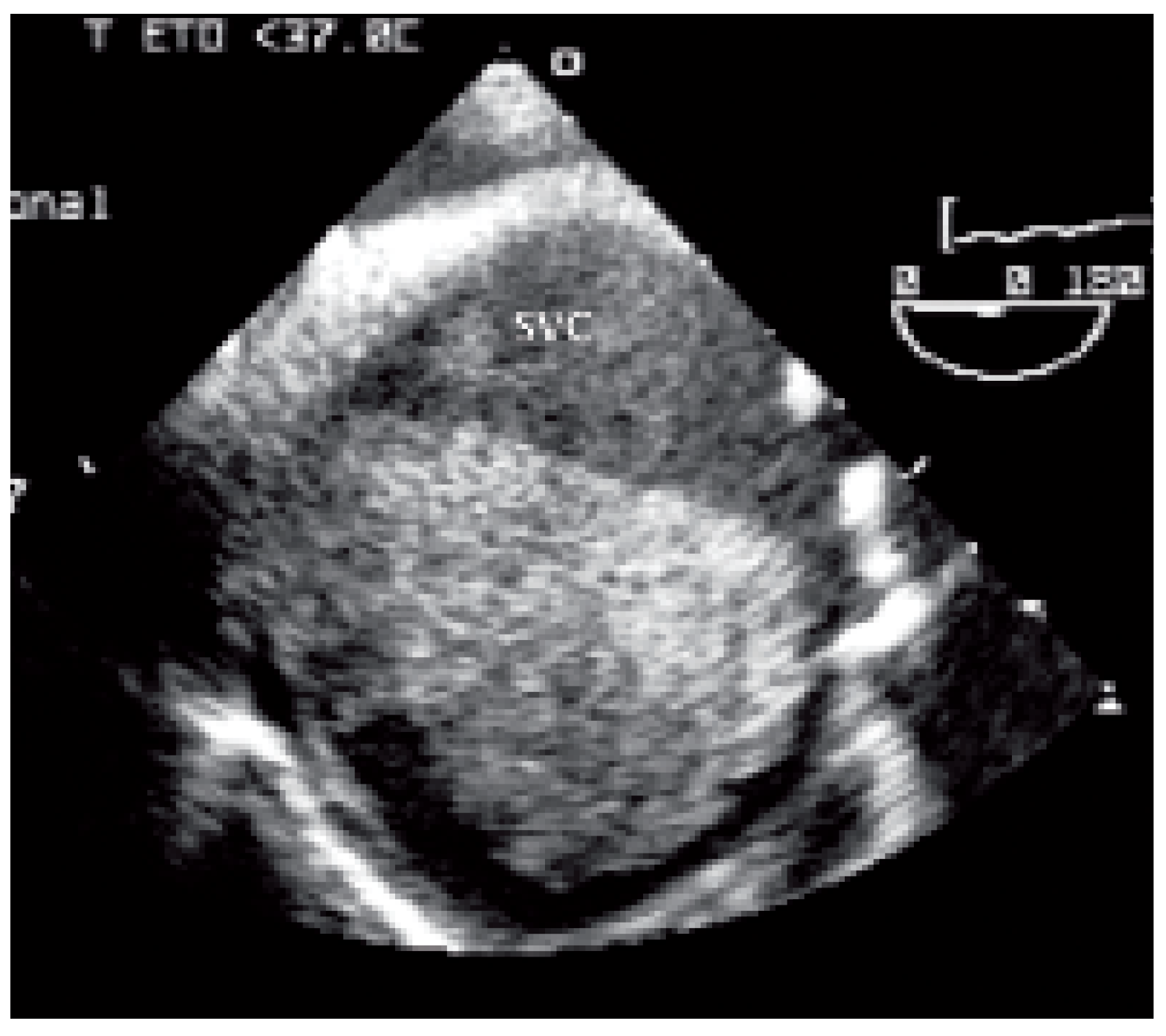 Cardiovascmed 09 00167 g005 Cardiovascmed 09 00167 g005