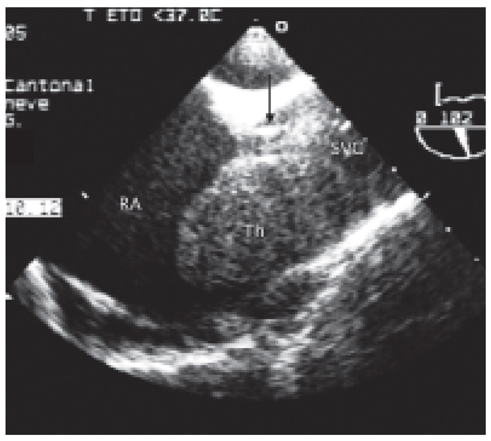 Cardiovascmed 09 00167 g006 Cardiovascmed 09 00167 g006