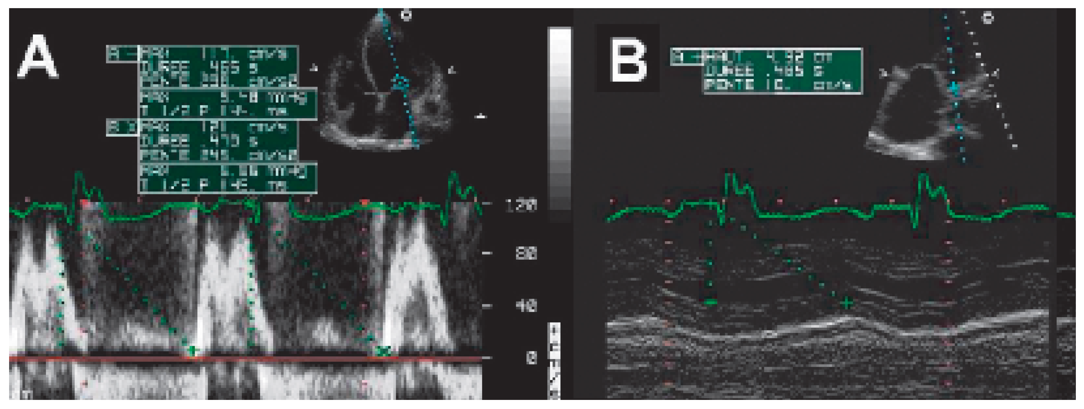 Cardiovascmed 09 00188 g002
