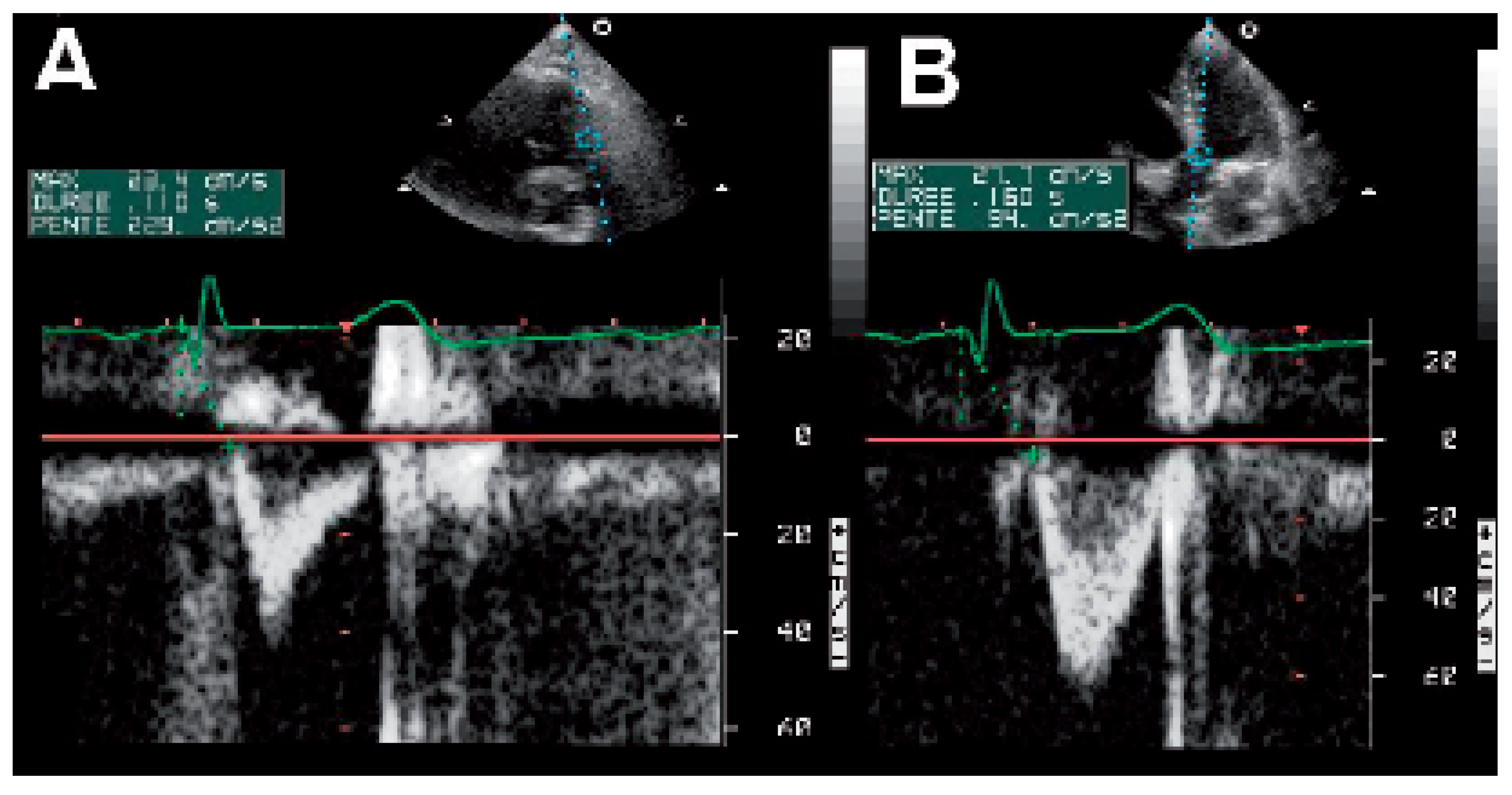 Cardiovascmed 09 00188 g003