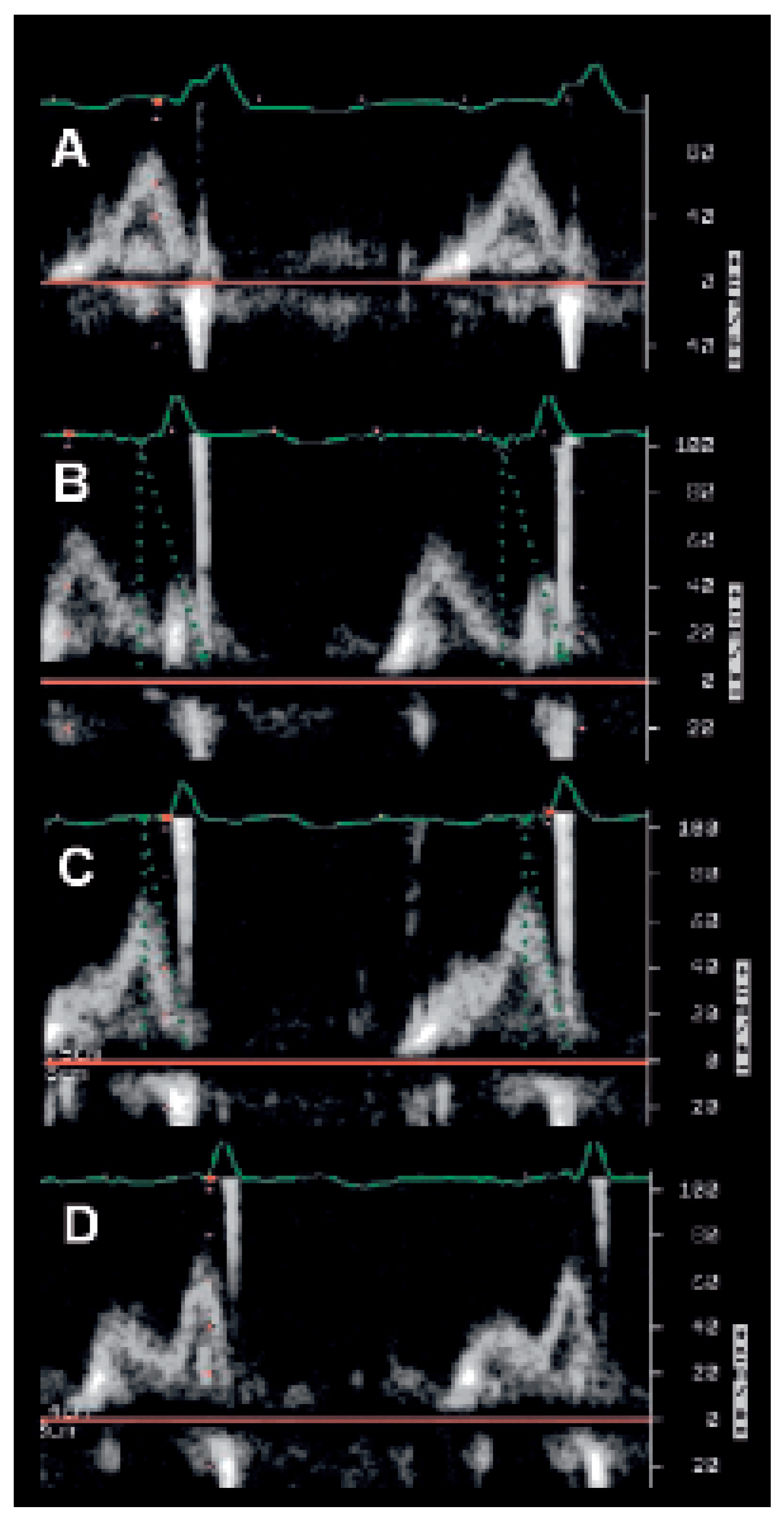 Cardiovascmed 09 00188 g006