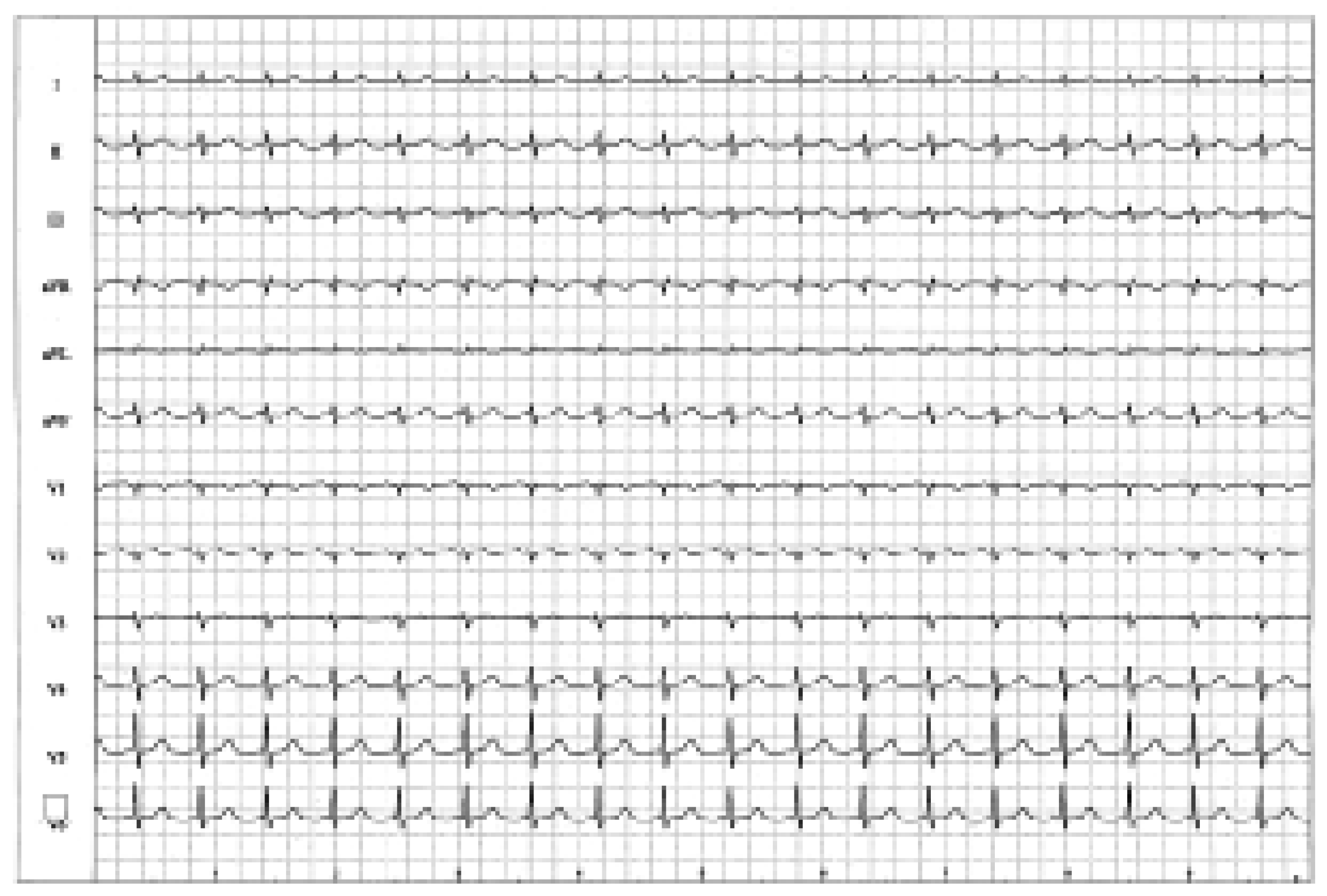 Cardiovascmed 09 00197 g001 Cardiovascmed 09 00197 g001