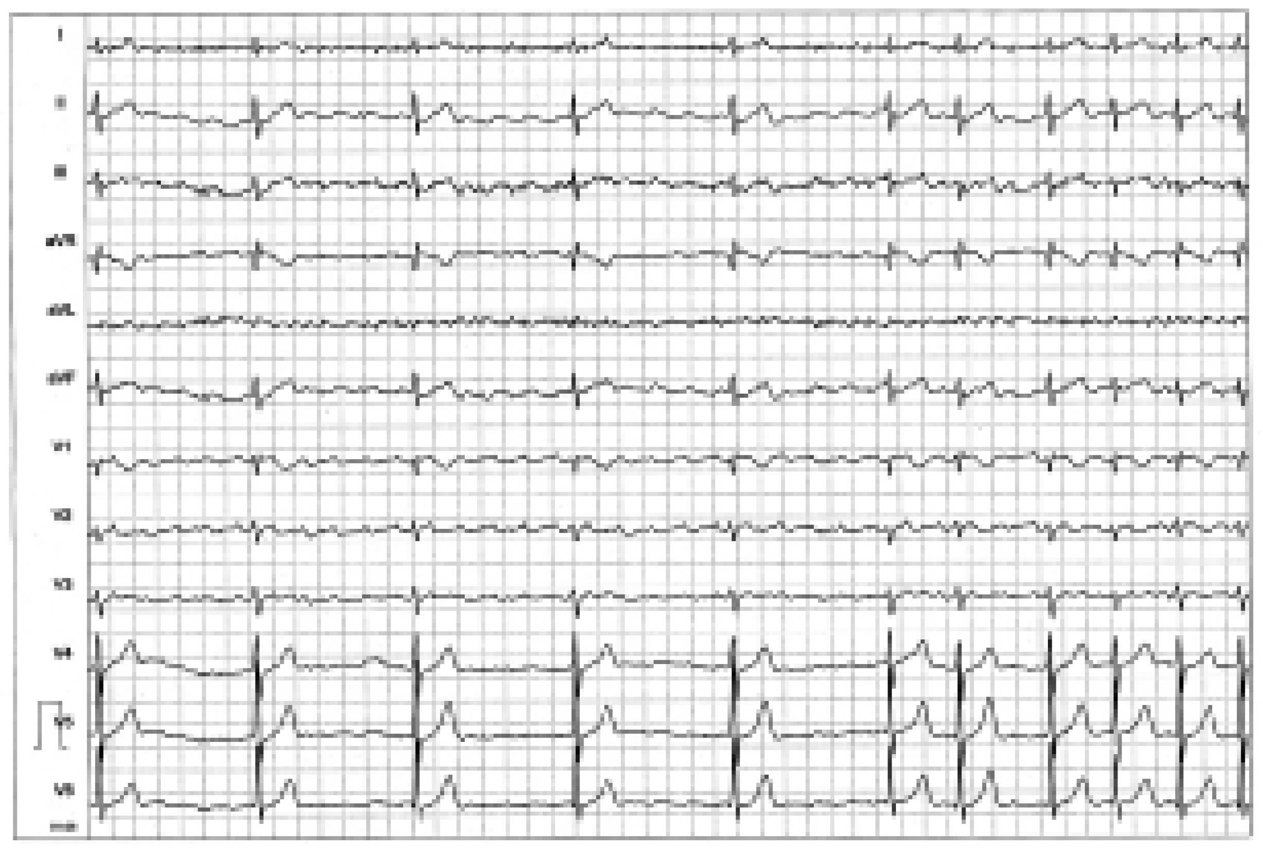 Cardiovascmed 09 00197 g002 Cardiovascmed 09 00197 g002