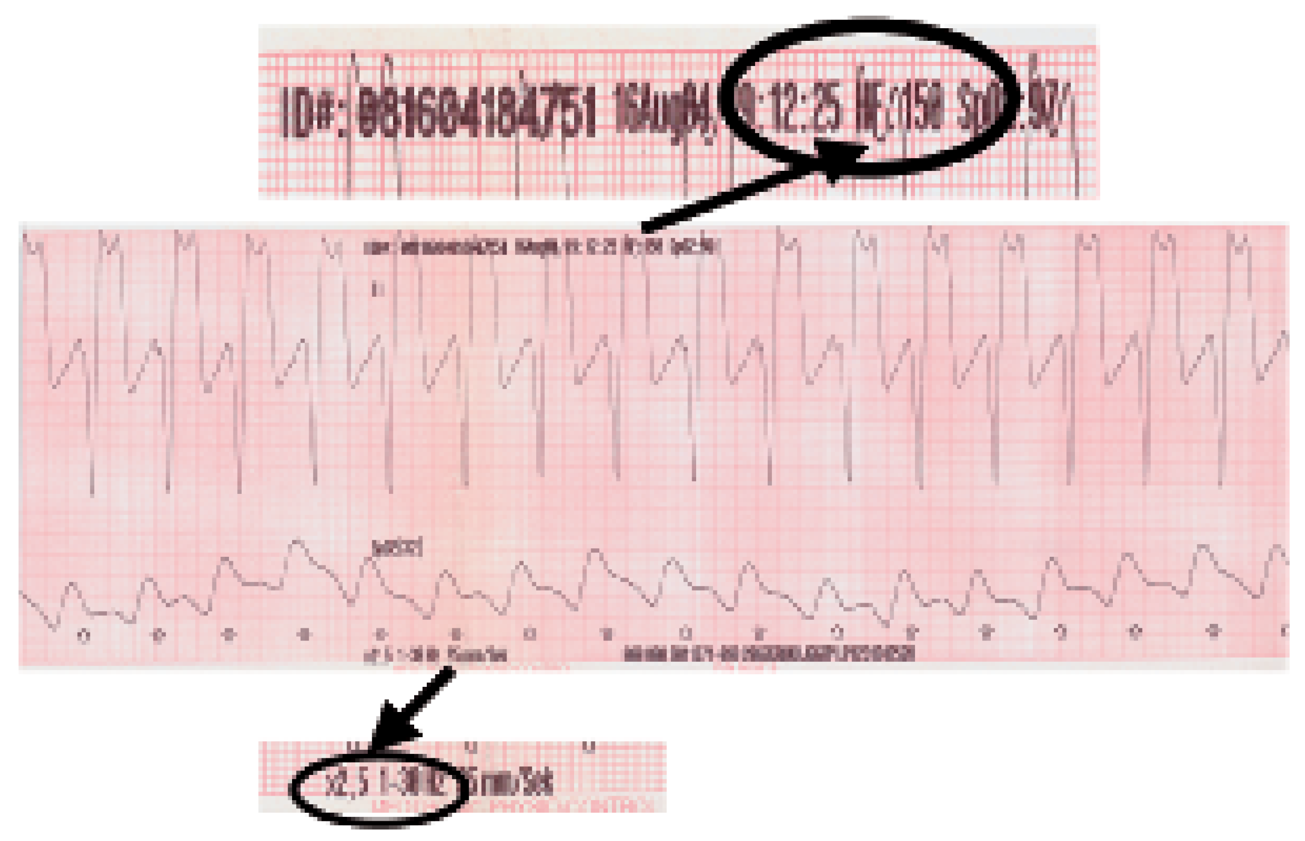 Cardiovascmed 09 00227 g001