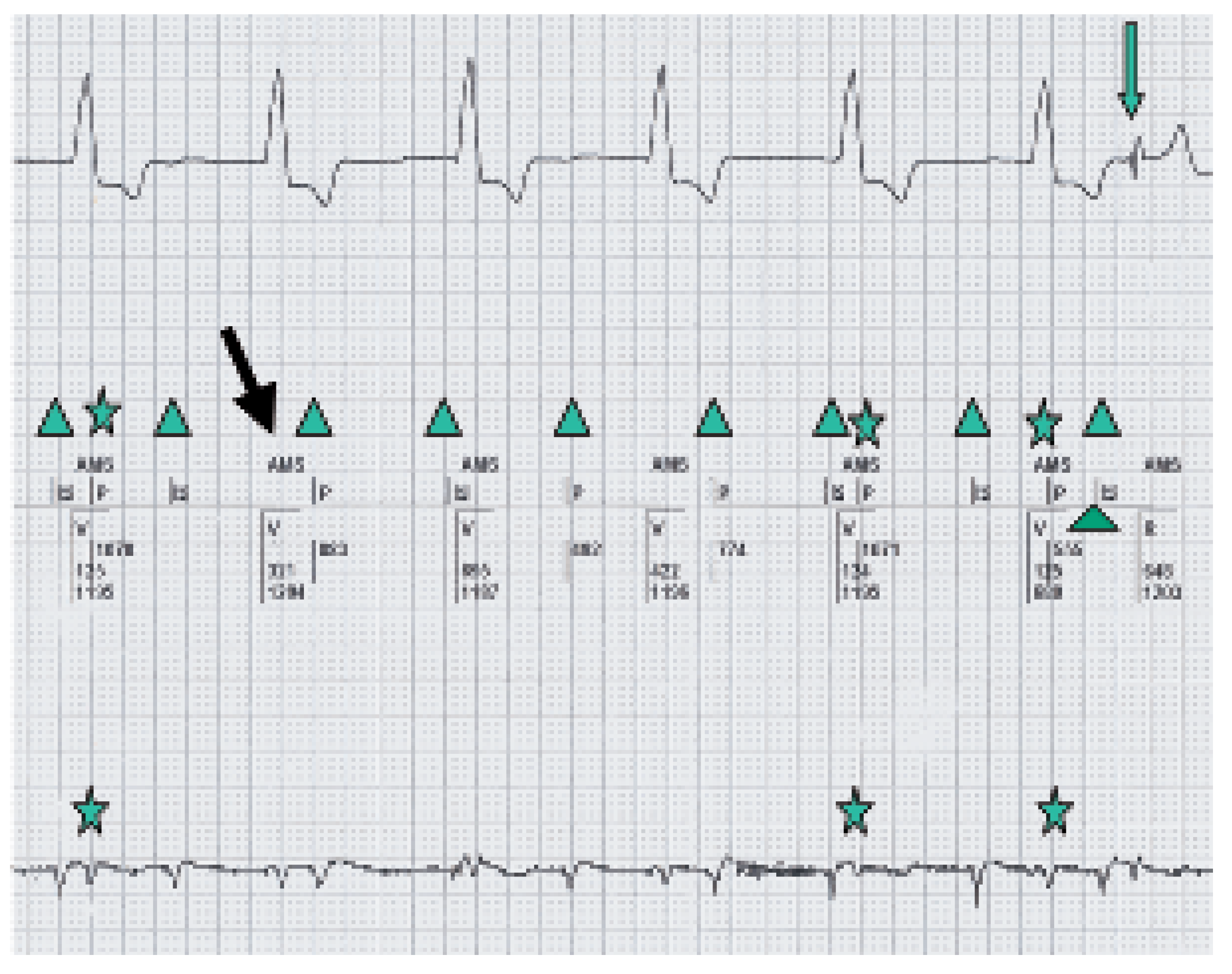 Cardiovascmed 09 00227 g002