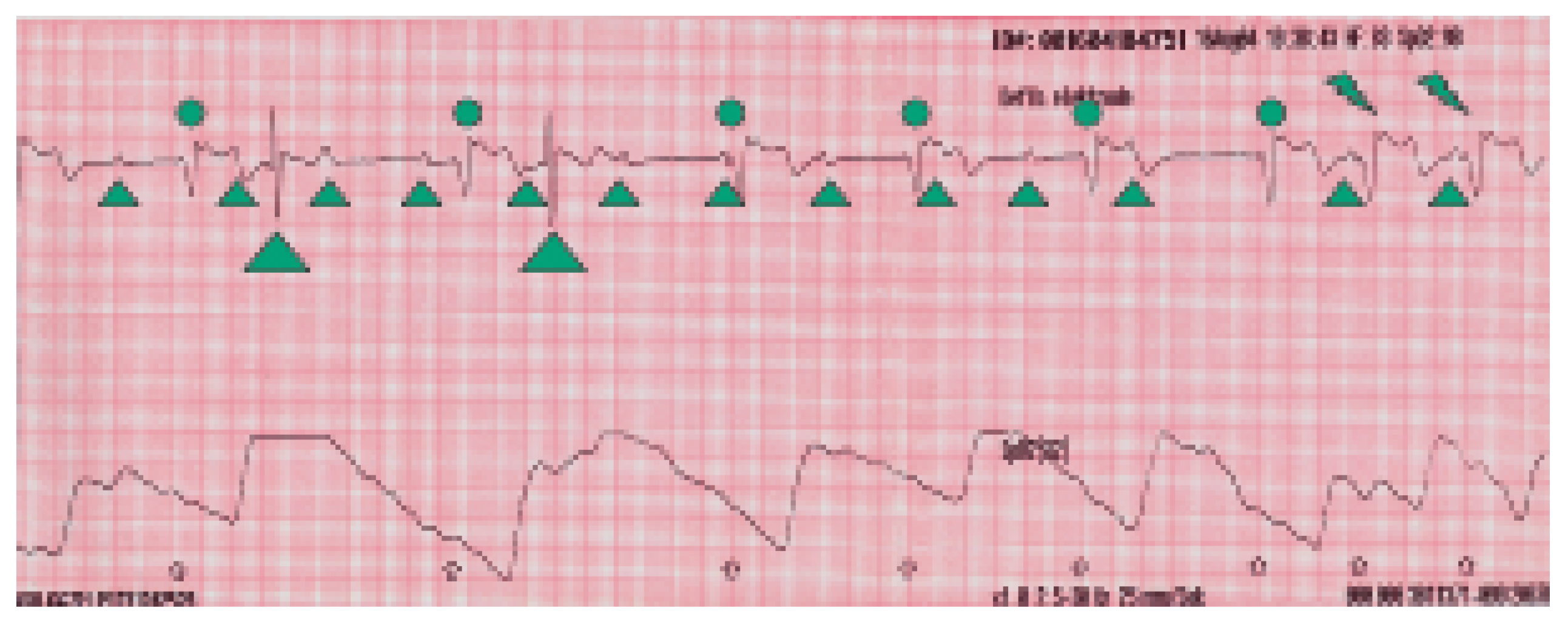 Cardiovascmed 09 00227 g003