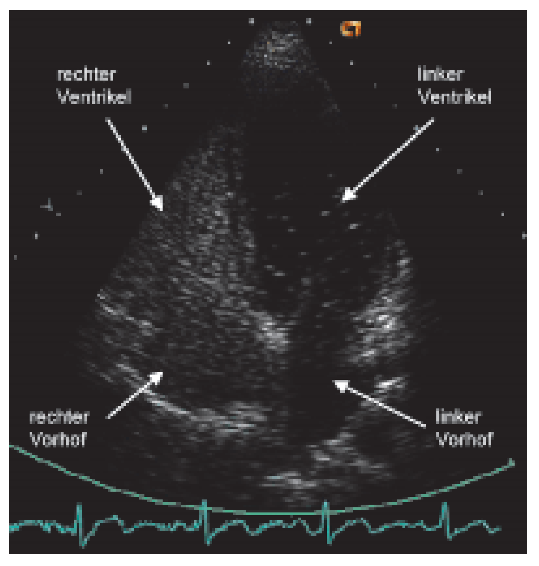 Cardiovascmed 09 00230 g001