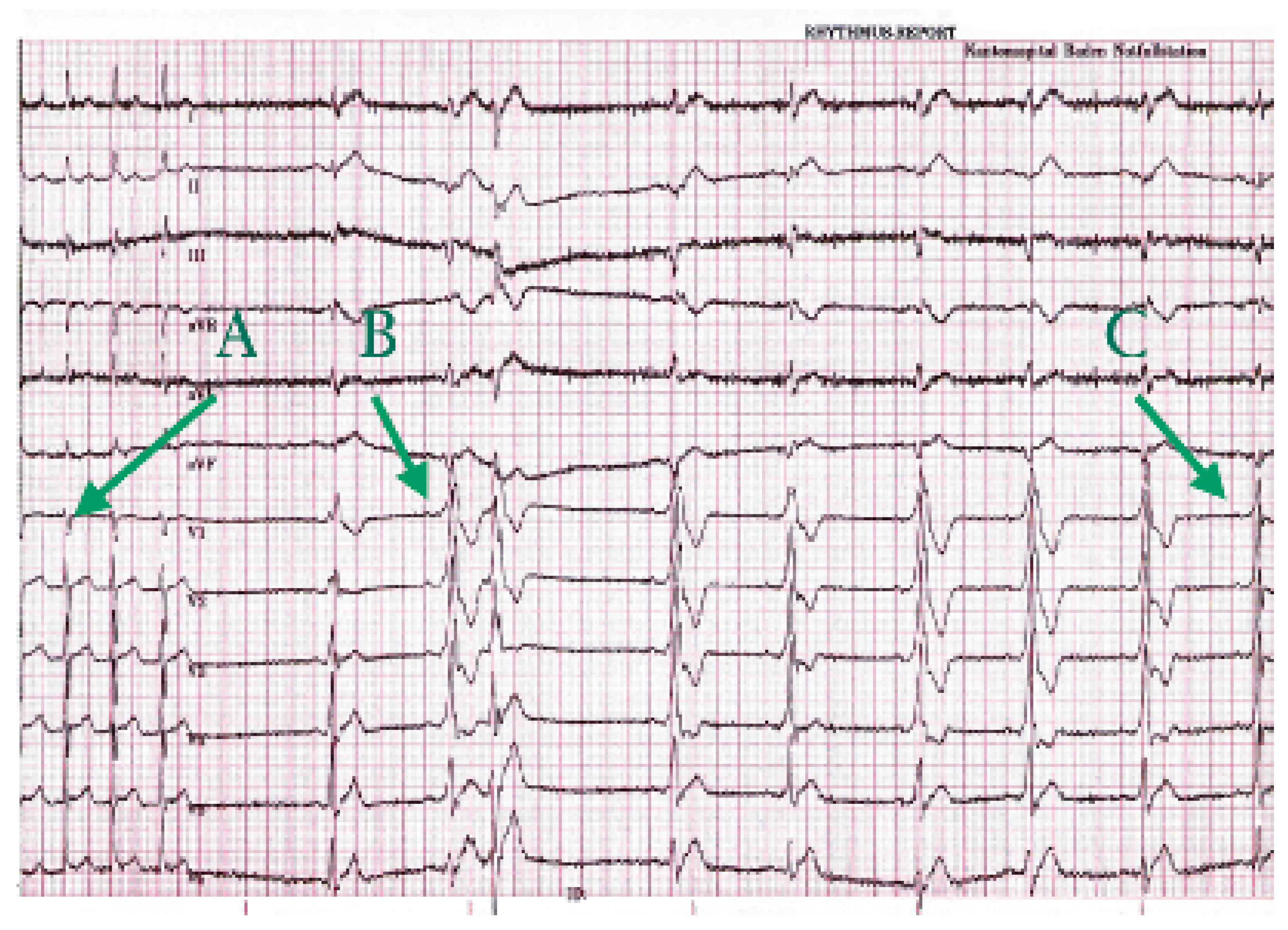 Cardiovascmed 09 00235 g001