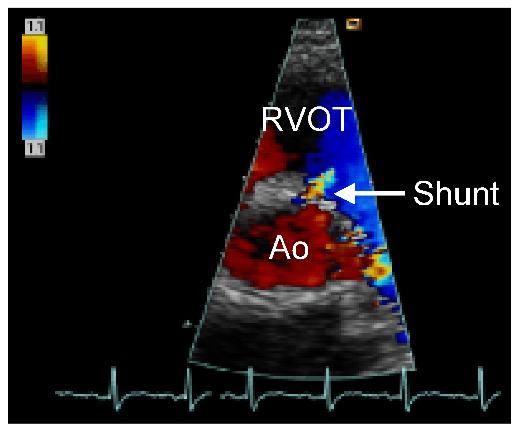 Cardiovascmed 09 00238 g001