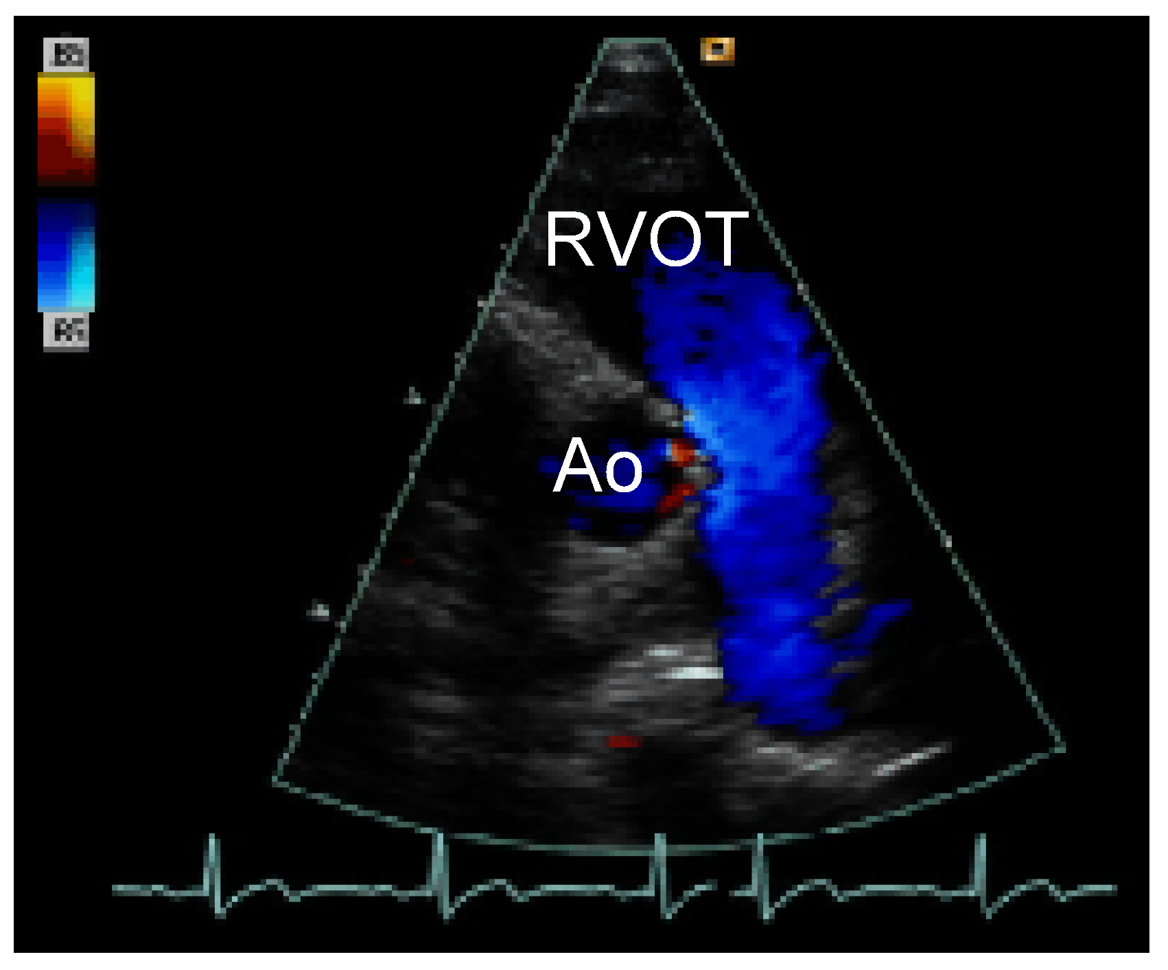 Cardiovascmed 09 00238 g002