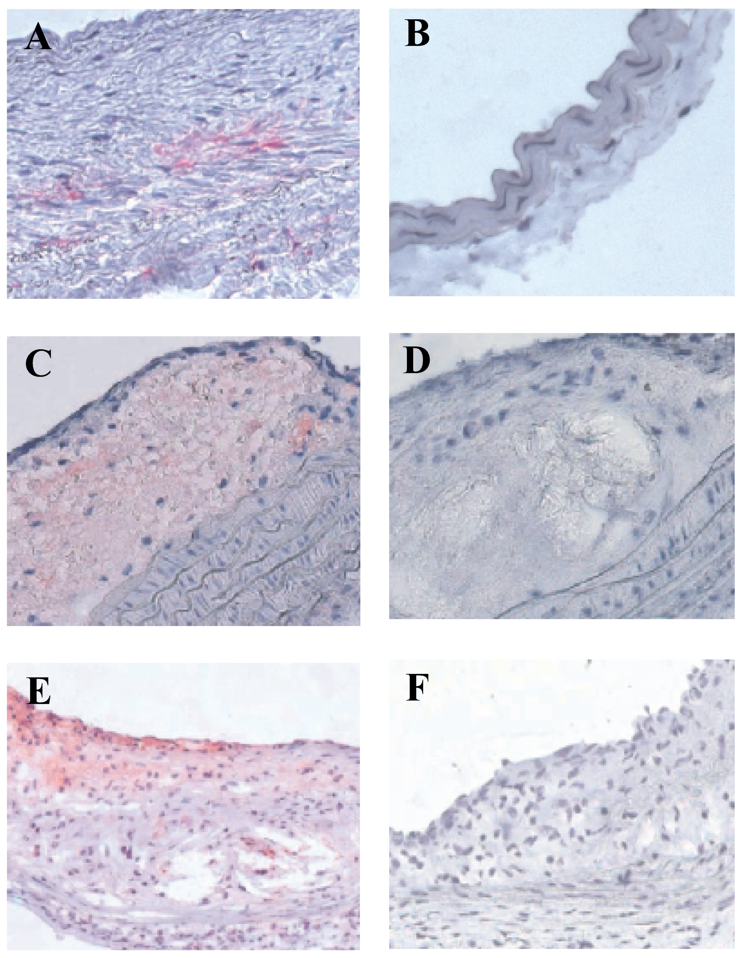 Cardiovascmed 09 00268 g002