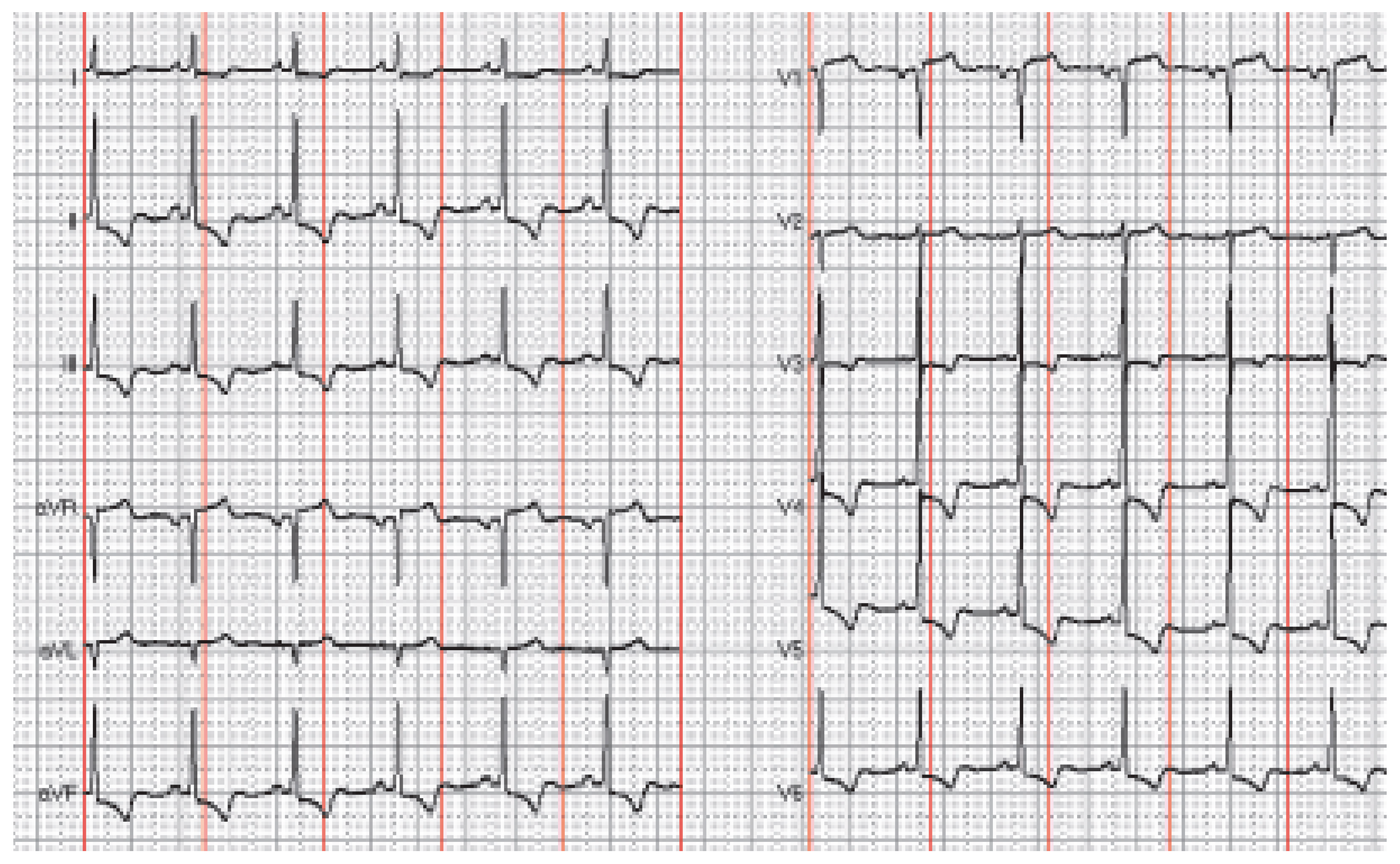 Cardiovascmed 09 00276 g001