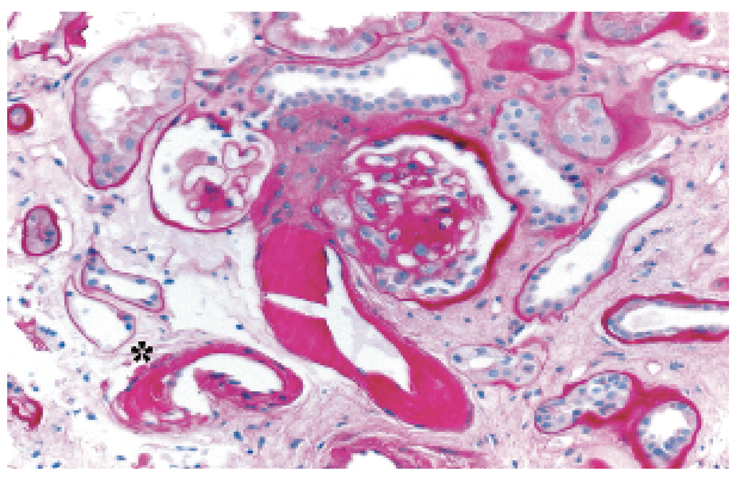 Cardiovascmed 09 00278 g002 Cardiovascmed 09 00278 g002