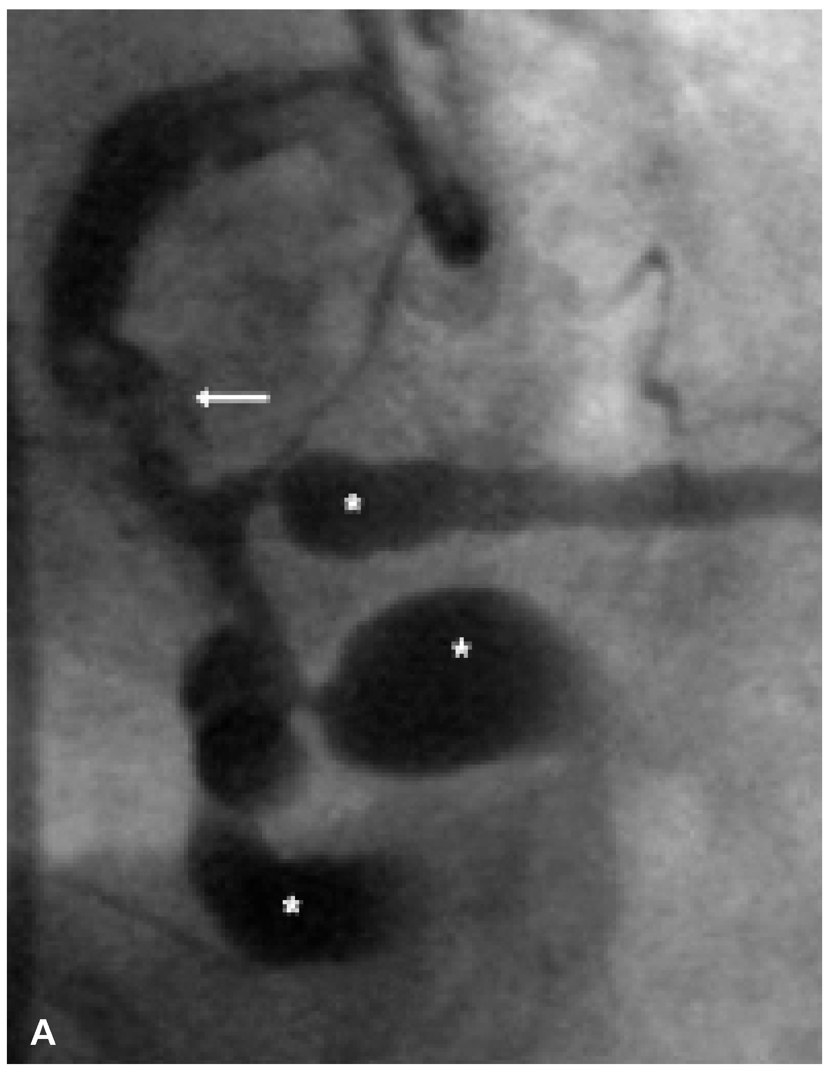 Cardiovascmed 09 00348 g001a