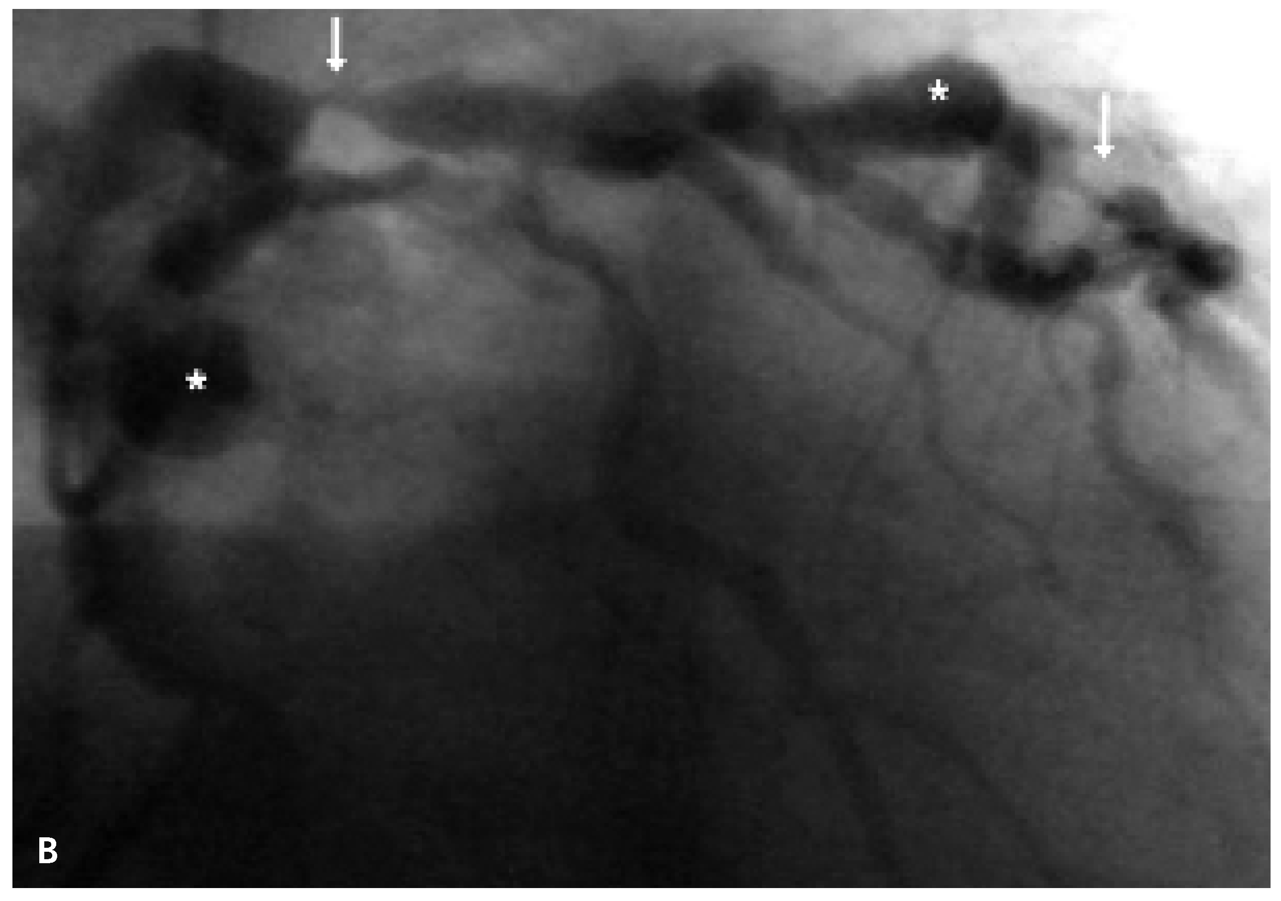 Cardiovascmed 09 00348 g001b