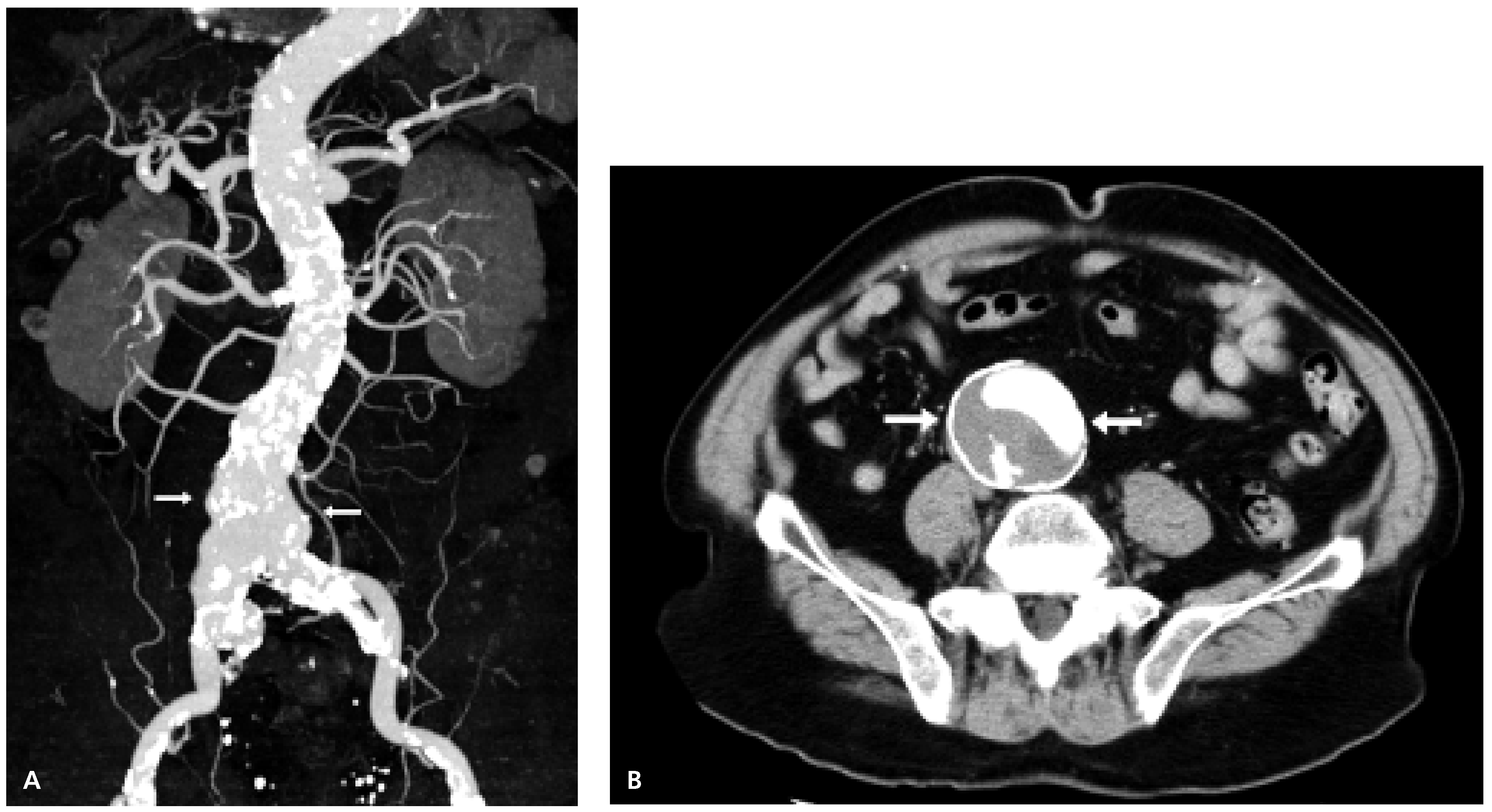 Cardiovascmed 09 00348 g002