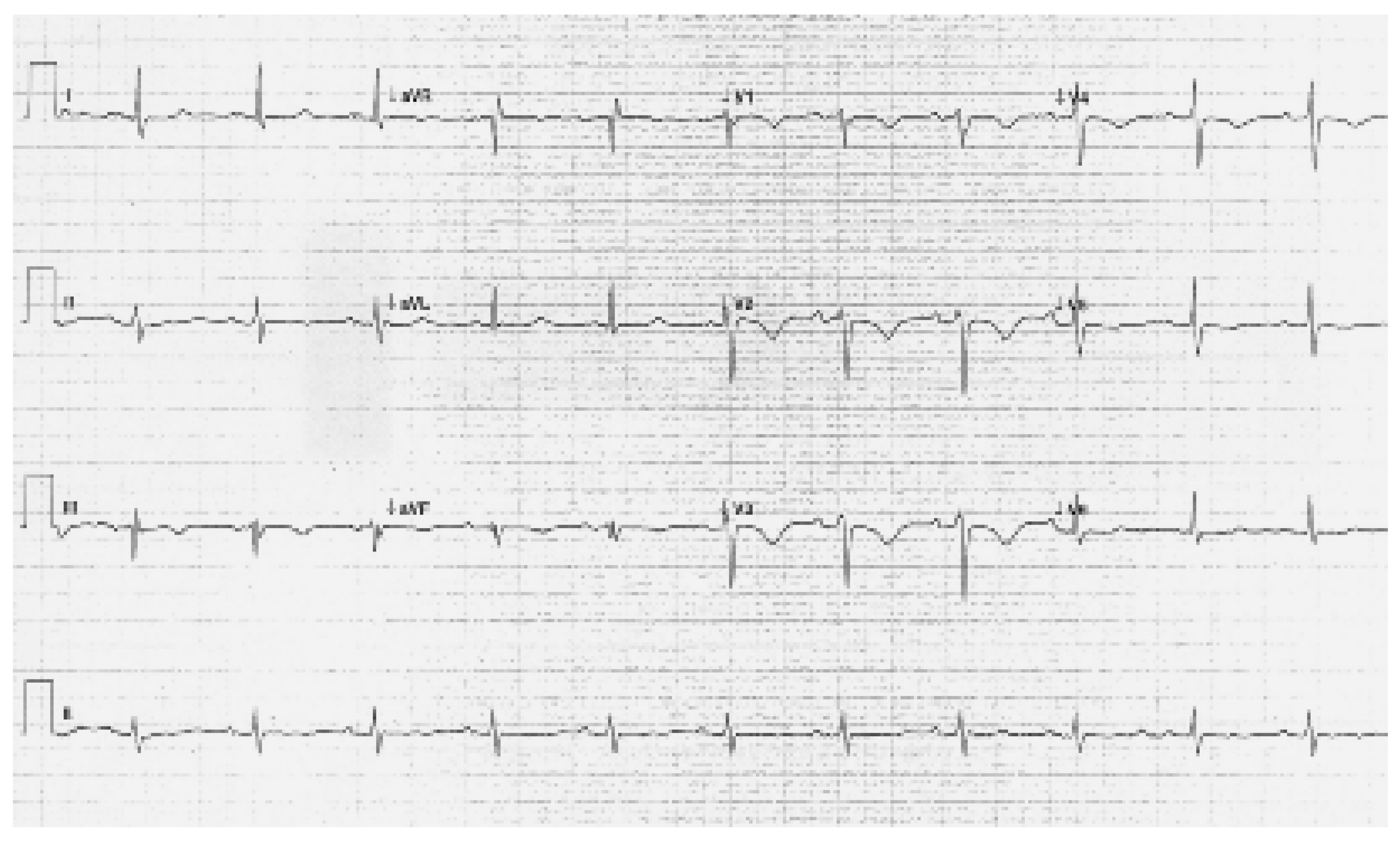 Cardiovascmed 09 00359 g002