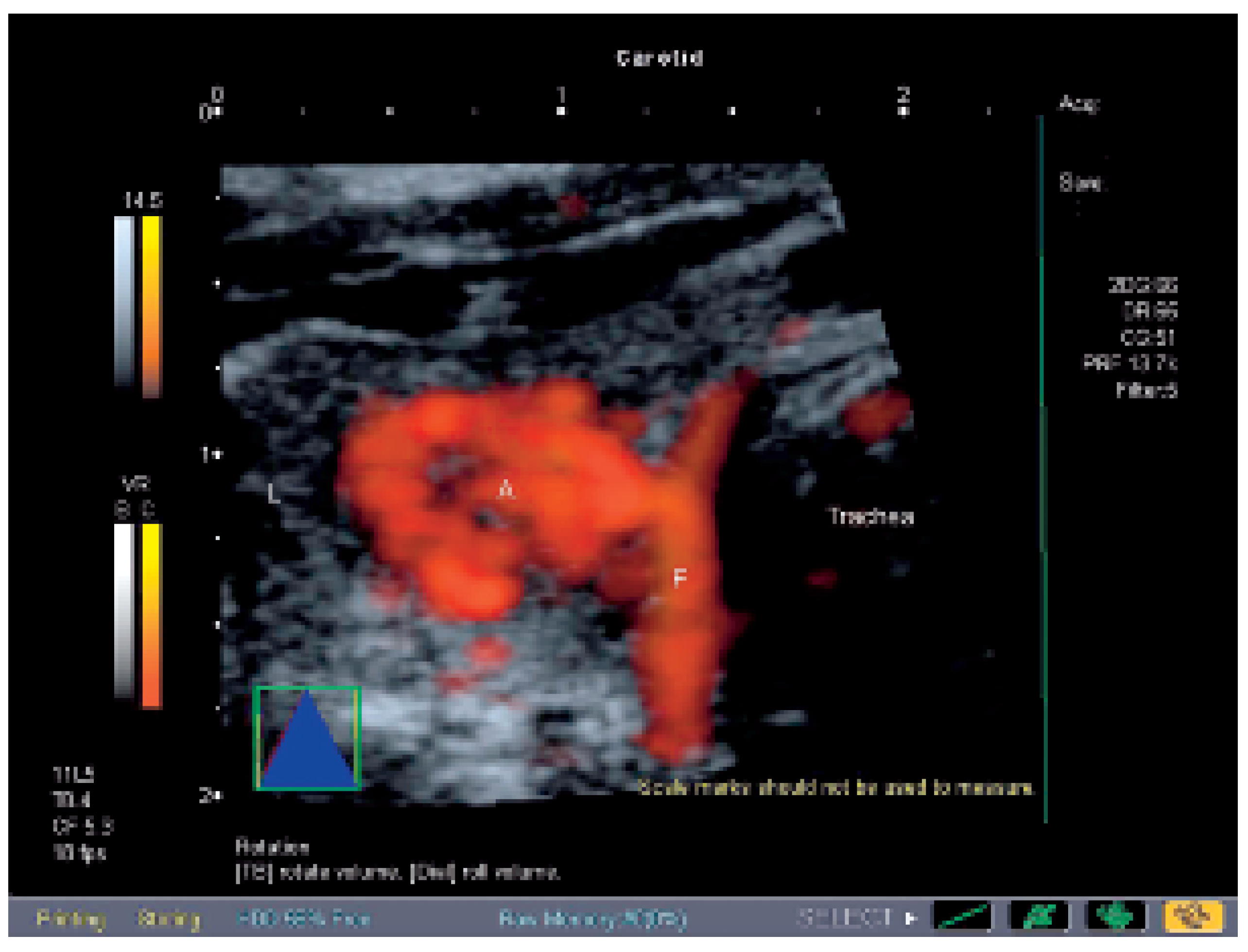 Cardiovascmed 09 00361 g002