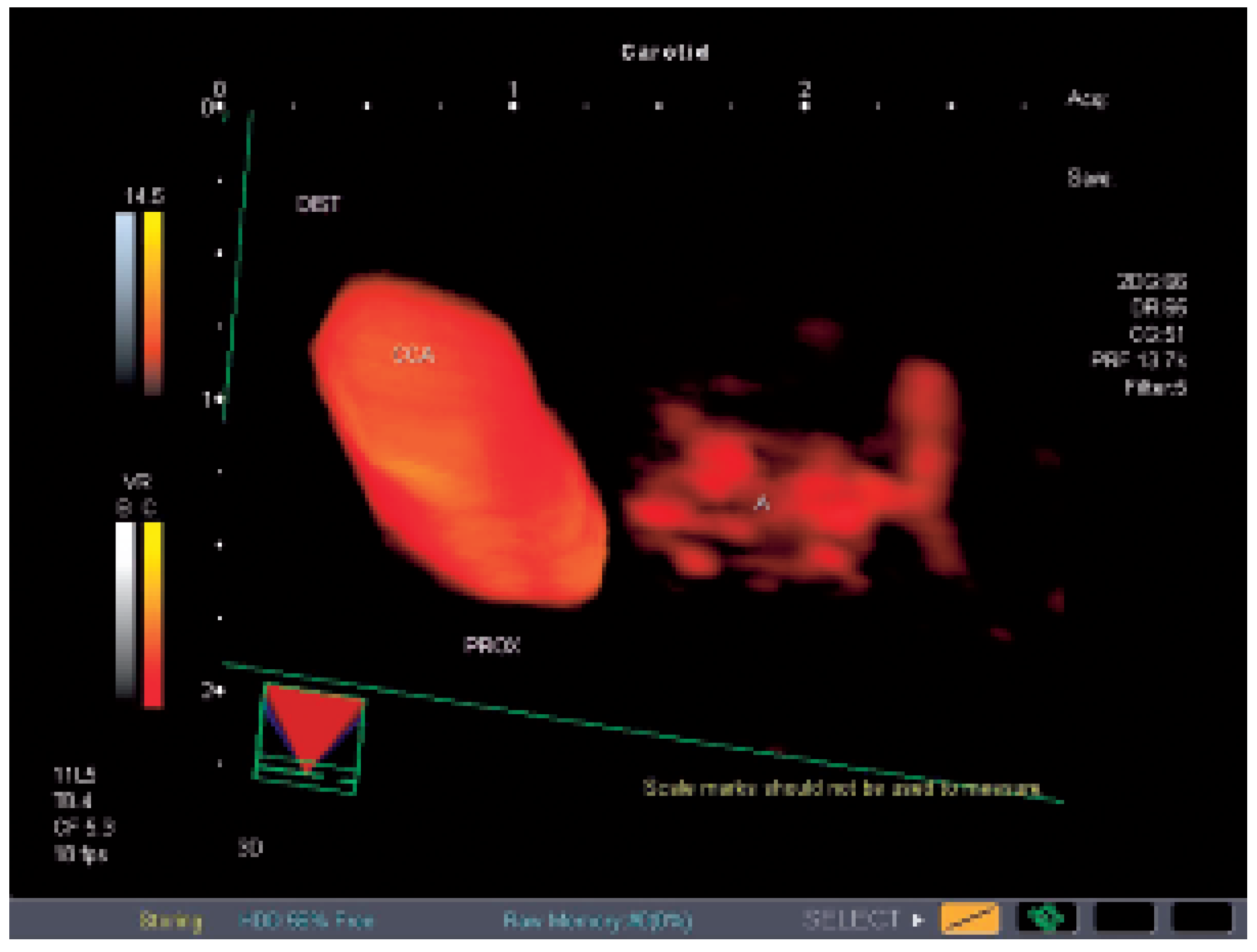 Cardiovascmed 09 00361 g003